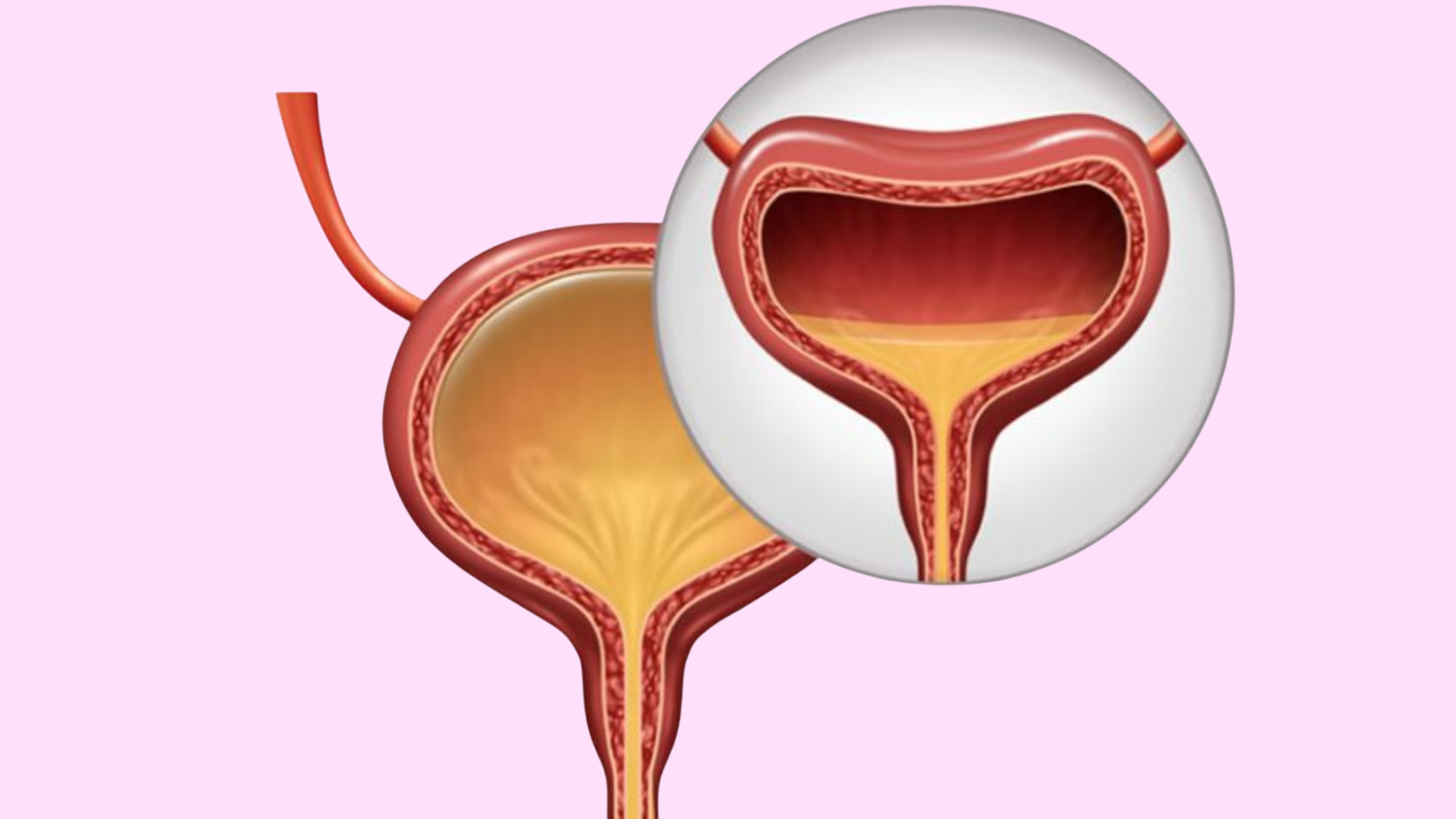 Nguyên nhân và cách khắc phục tiểu đêm nhiều ở nữ giới 2