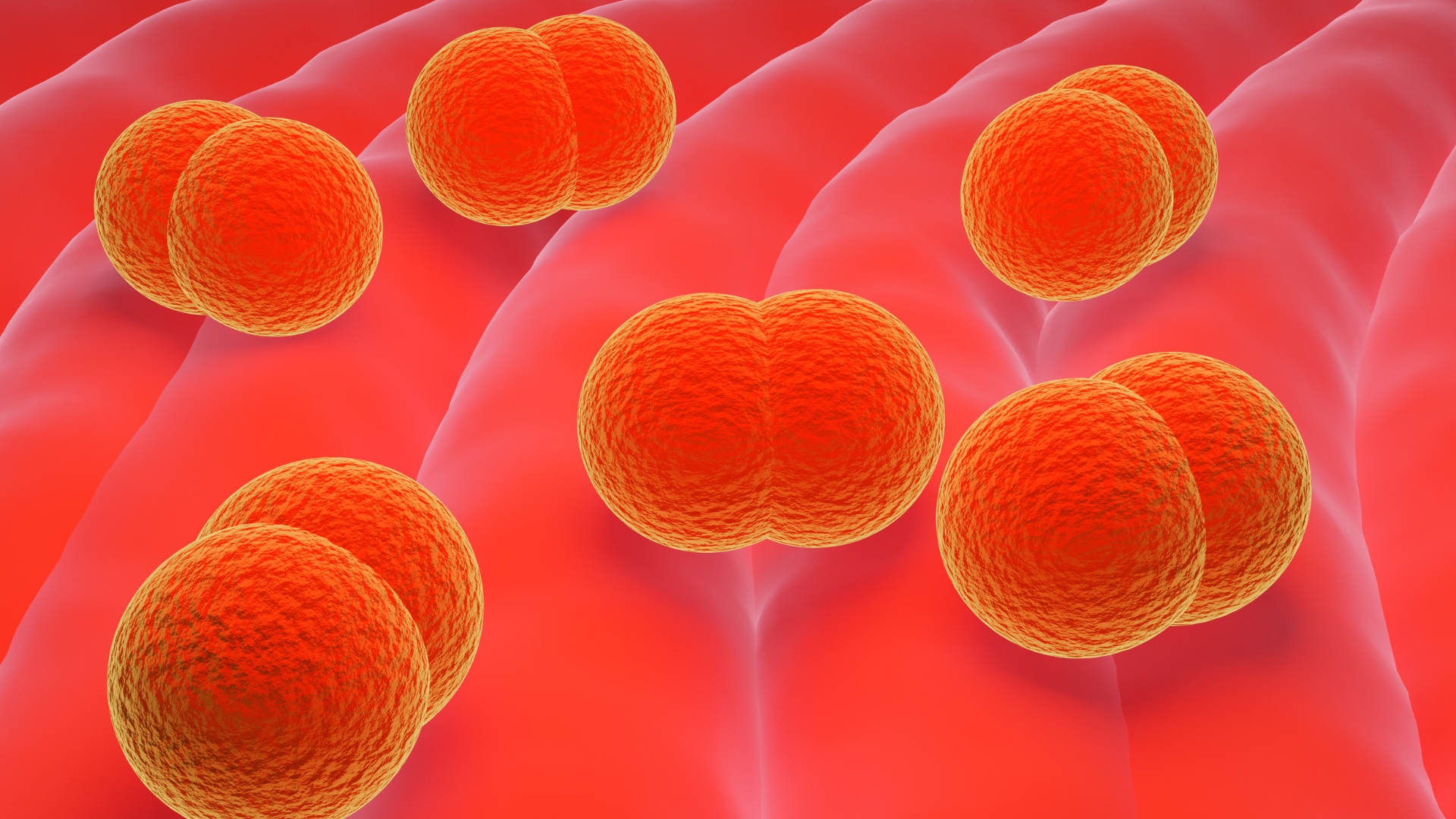 Viêm màng não mủ do não mô cầu có thể gây viêm màng não mủ với diễn tiến rất nhanh và nặng