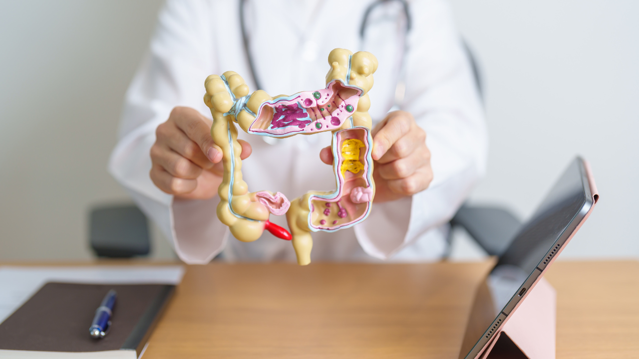 Polyp đại tràng dễ bị nhầm lẫn với các bệnh lý tiêu hóa