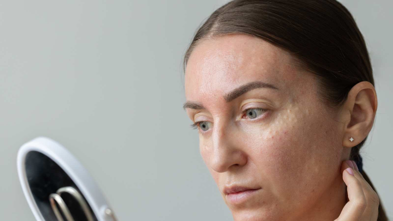 Nhận diện chàm đúng để chữa đúng