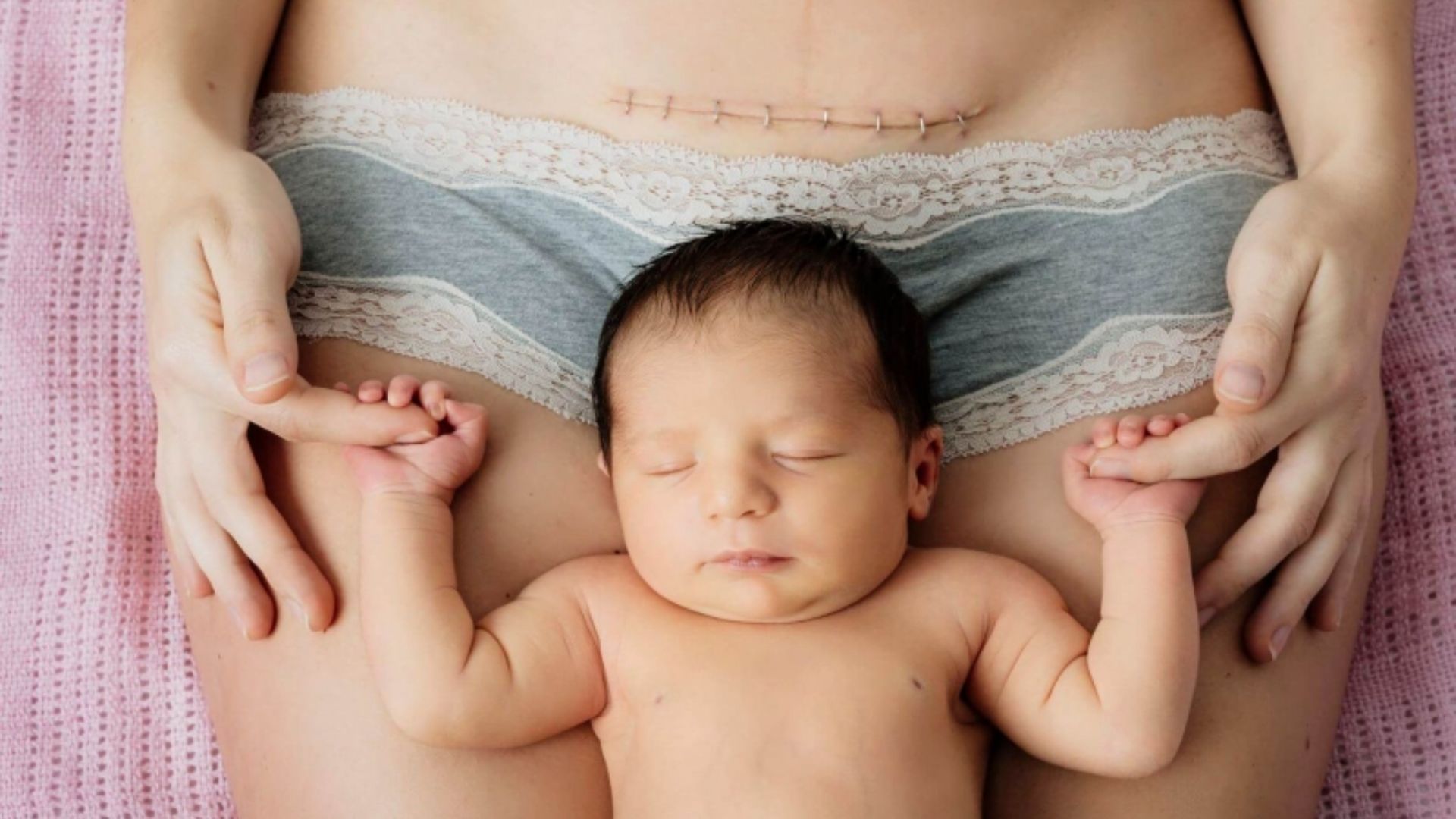 Bác sĩ sẽ chỉ định mẹ bầu bị nhau tiền đạo sinh mổ ngay nếu thai nhi có dấu hiệu suy