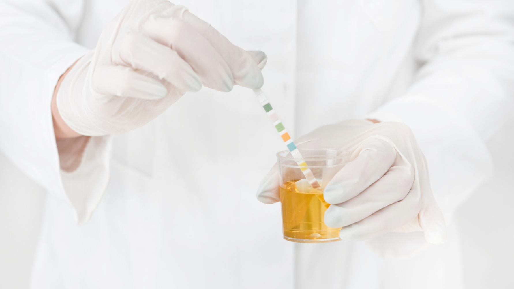 Xét nghiệm nước tiểu để tìm protein trong nước tiểu là xét nghiệm cần thiết để chẩn đoán nhiễm độc thai nghén