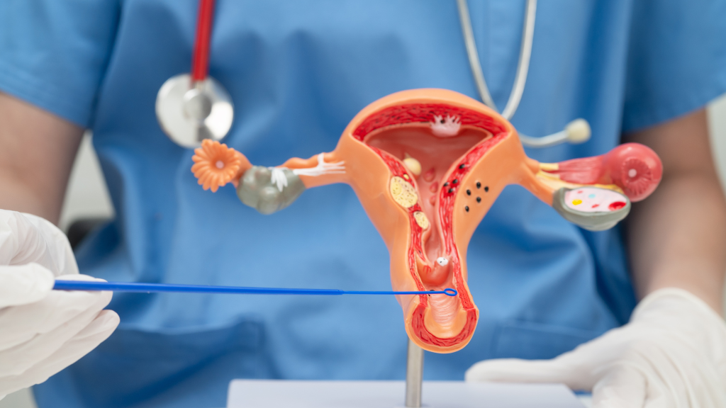 Nhiễm khuẩn hậu sản thường bắt nguồn từ đường sinh dục như âm đạo, cổ tử cung và tử cung