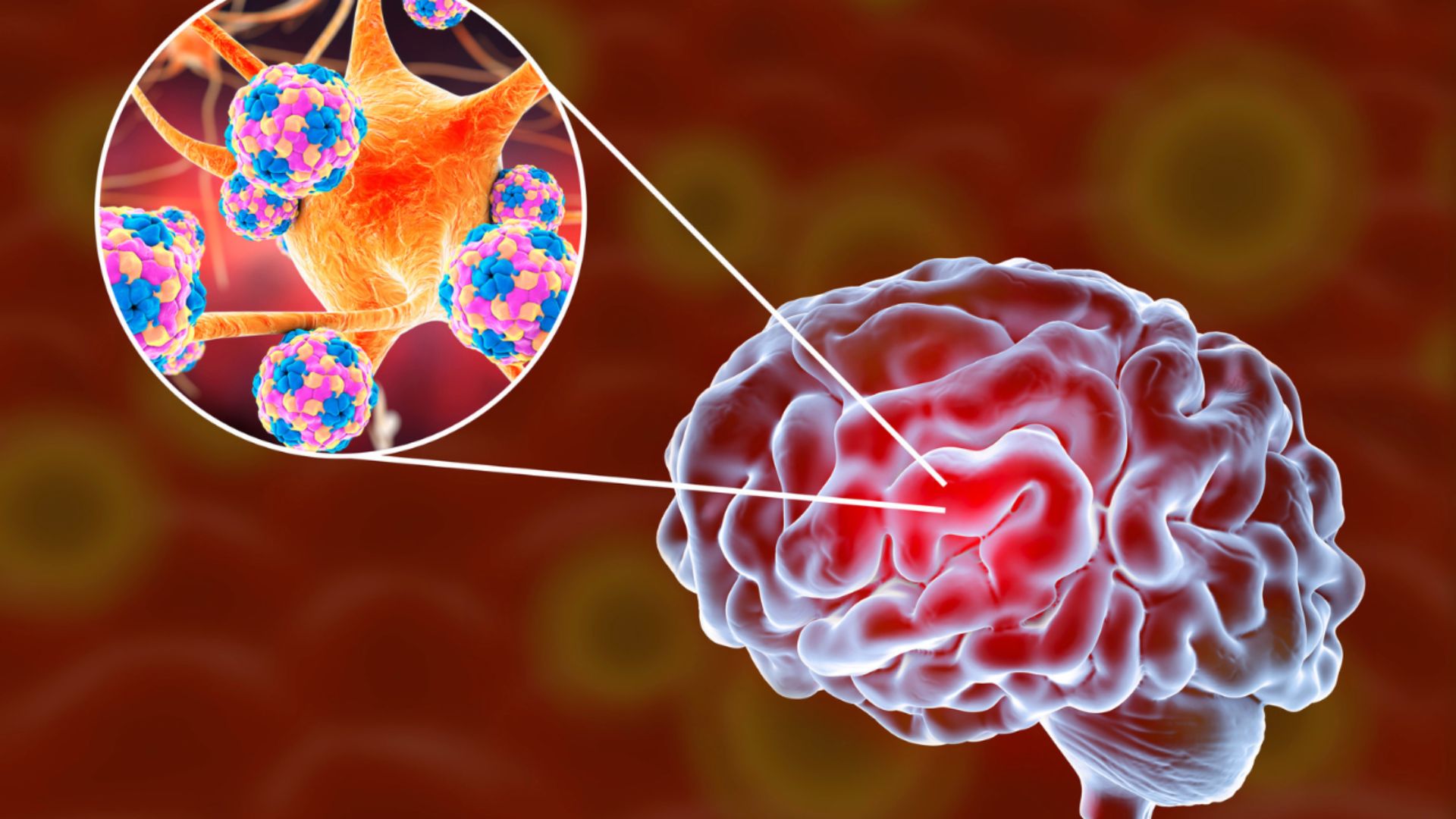 Nhiễm nấm Cryptococcus không được điều trị kịp thời có thể dẫn đến viêm màng não