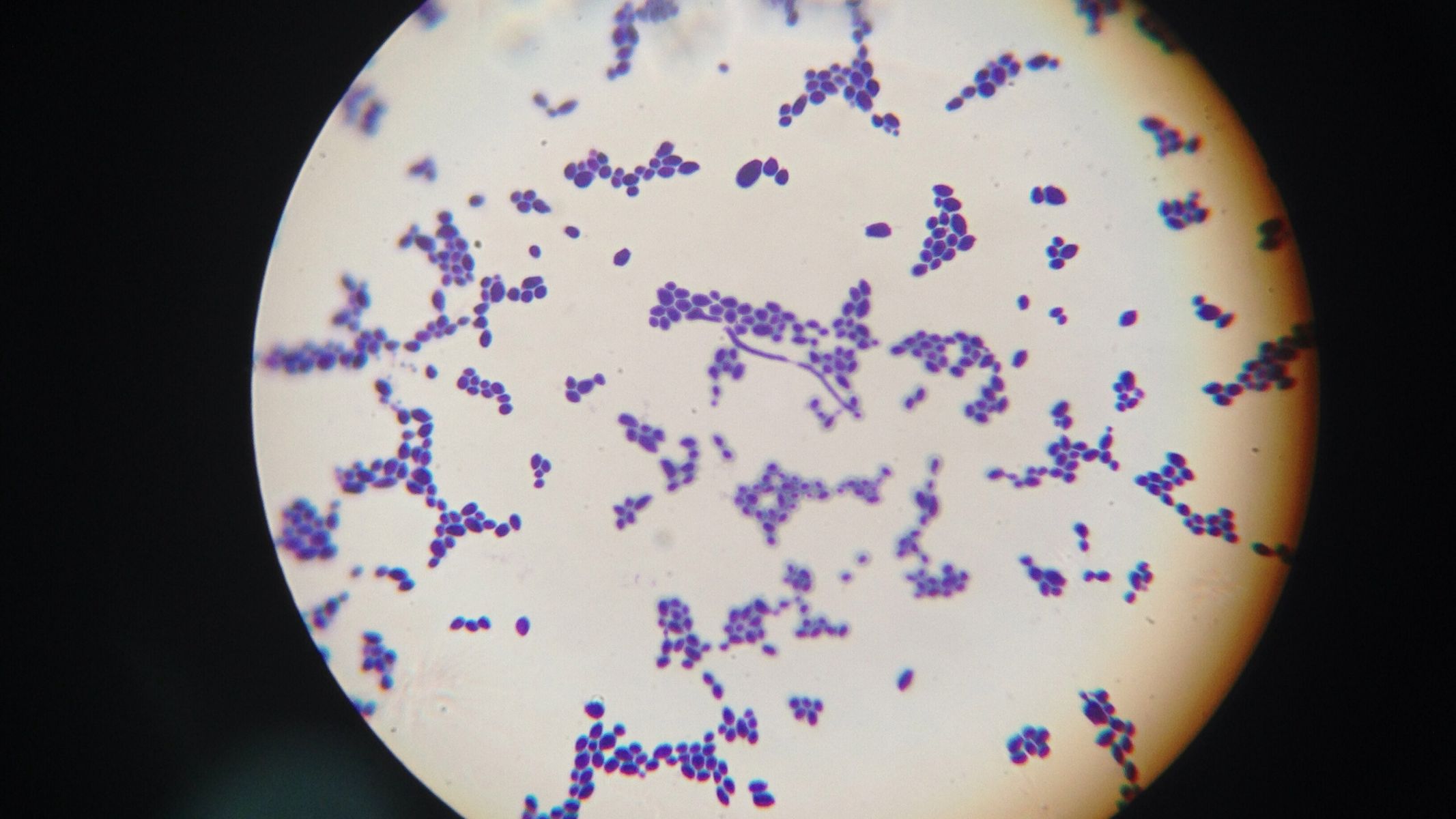 Trẻ bị nấm miệng Candida chủ yếu do nấm men Candida albicans phát triển quá mức trong khoang miệng