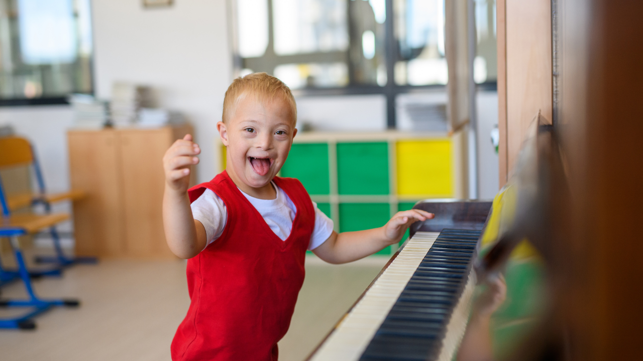 Hội chứng Down do thừa một nhiễm sắc thể số 21 (trisomy 21)