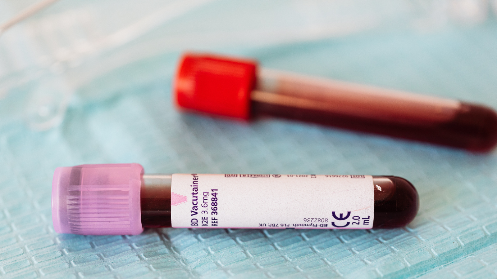 Nhiễm trùng máu do tổ đỉa bội nhiễm