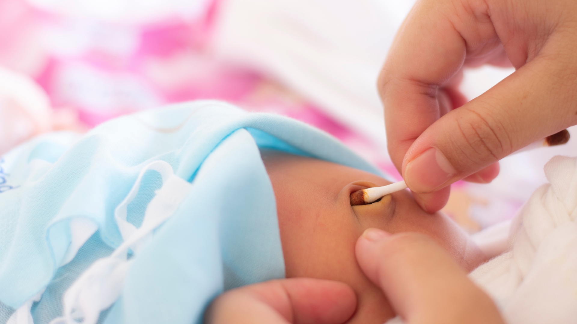 Chăm sóc rốn không đúng cách là một nguyên nhân gây nhiễm trùng rốn ở trẻ sơ sinh