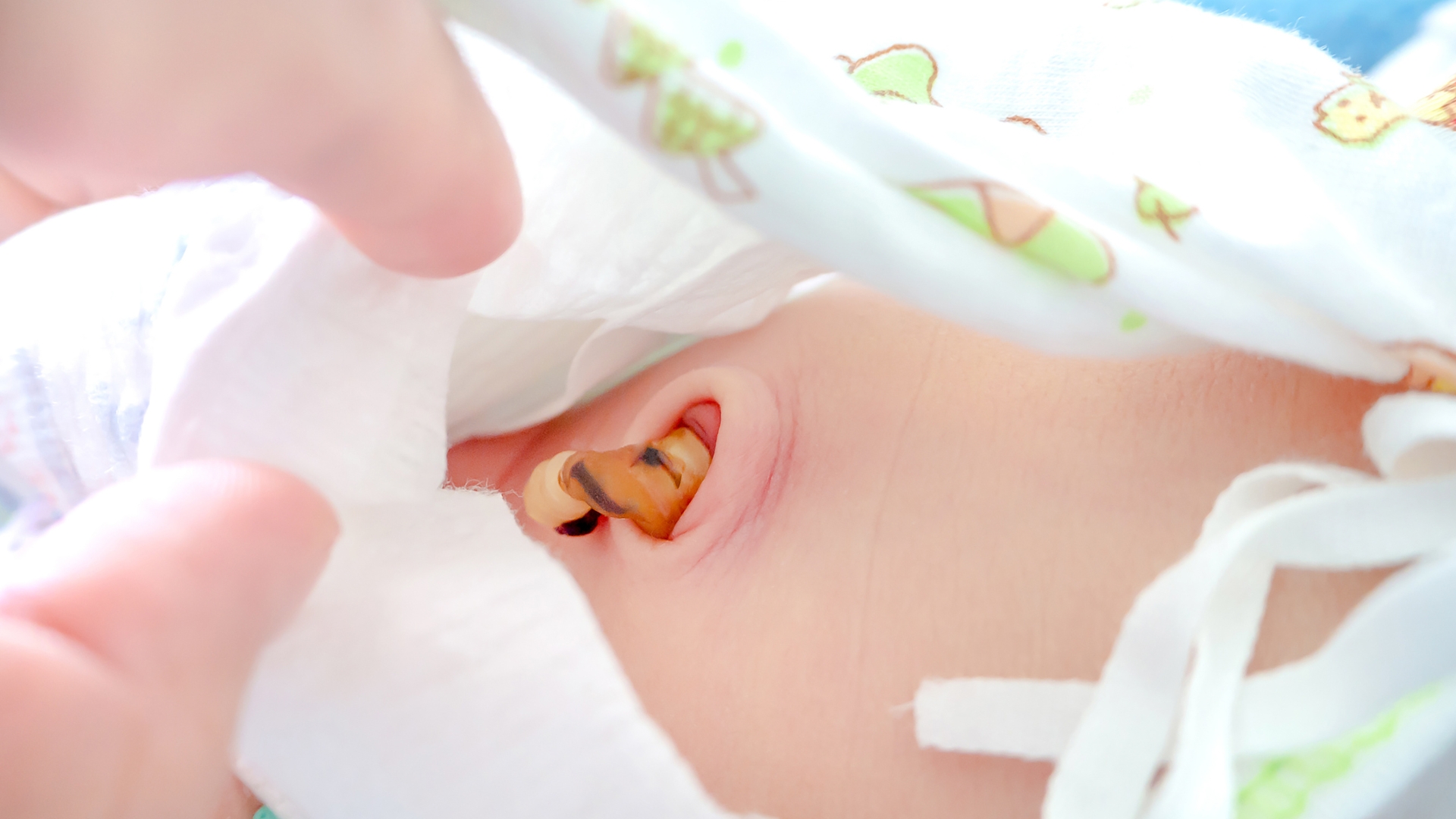 Gấp mép tã phía trước thấp xuống dưới rốn để tránh cọ xát và giúp vùng rốn luôn khô ráo