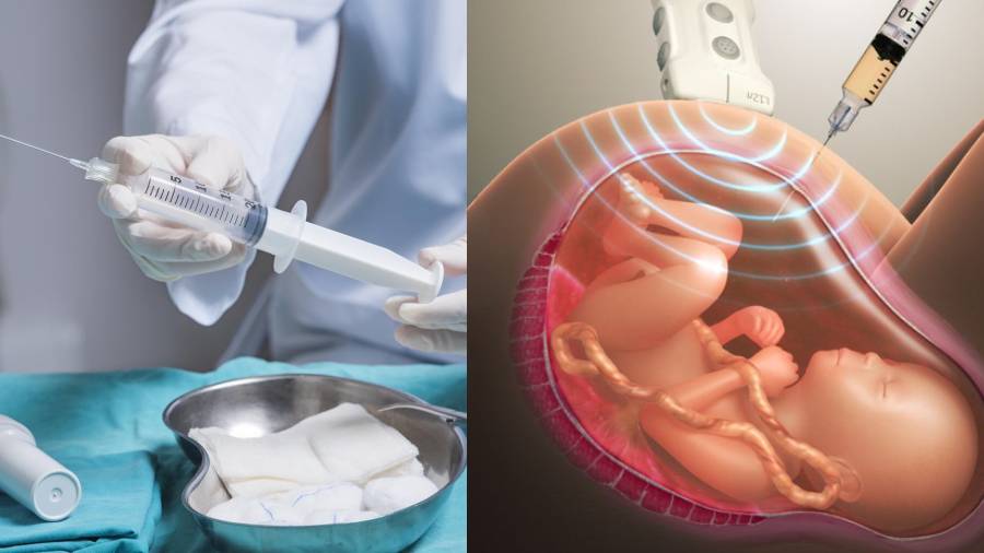 Nhịp tim thai 12 tuần biết trai hay gái có đúng hay không?4