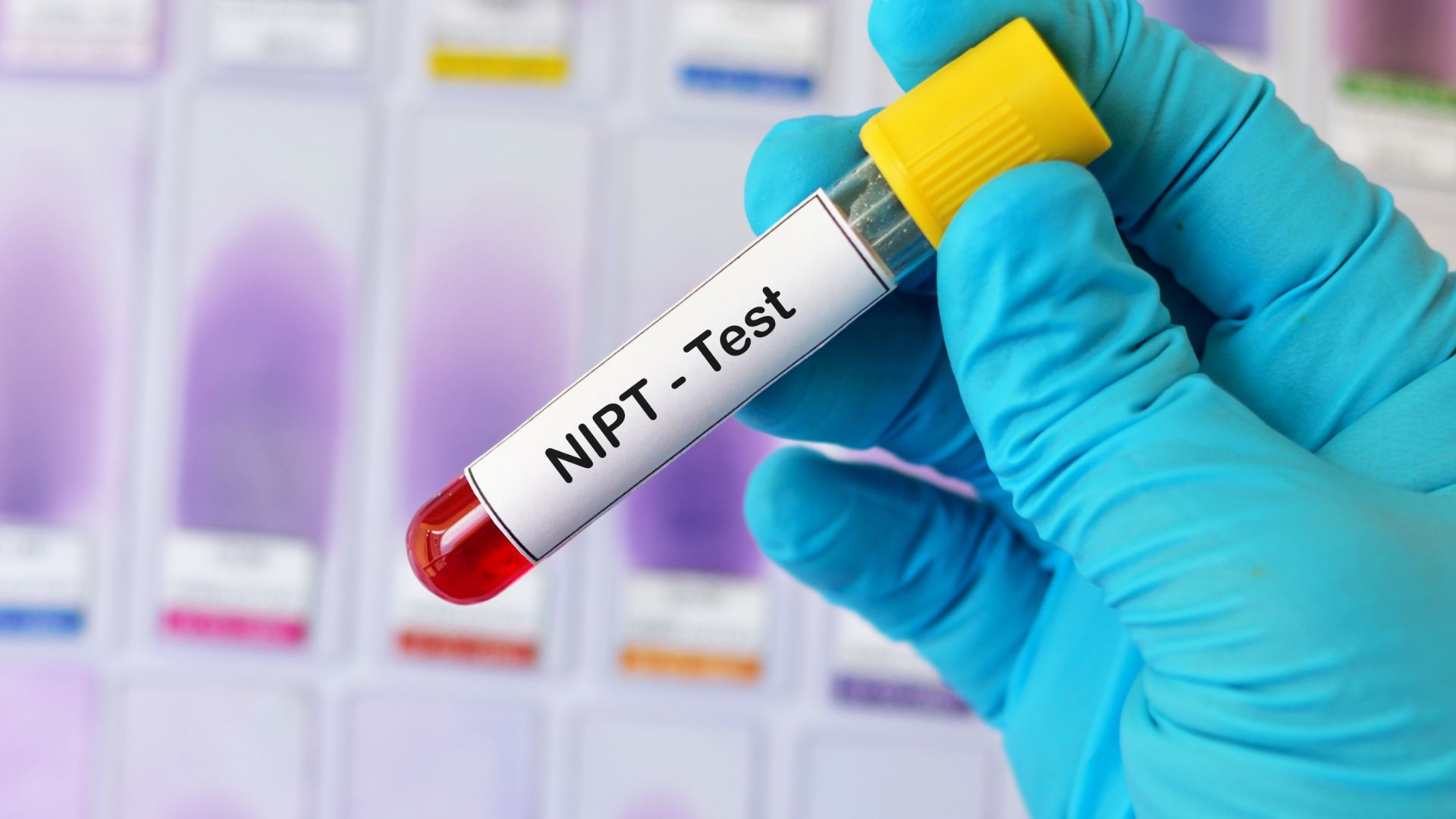 Nhịp tim thai 6 tuần biết trai hay gái hay chưa? Những cách biết giới tính thai nhi hiện nay 4