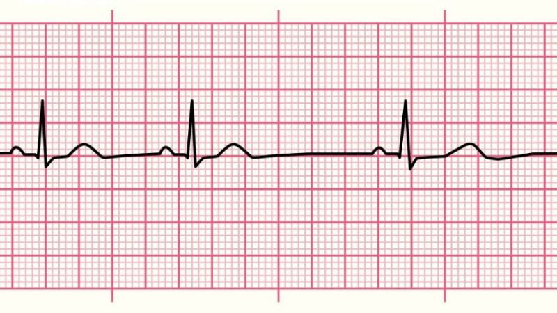 Nhịp xoang là gì thông qua cơ chế phát xung điện của nút xoang.