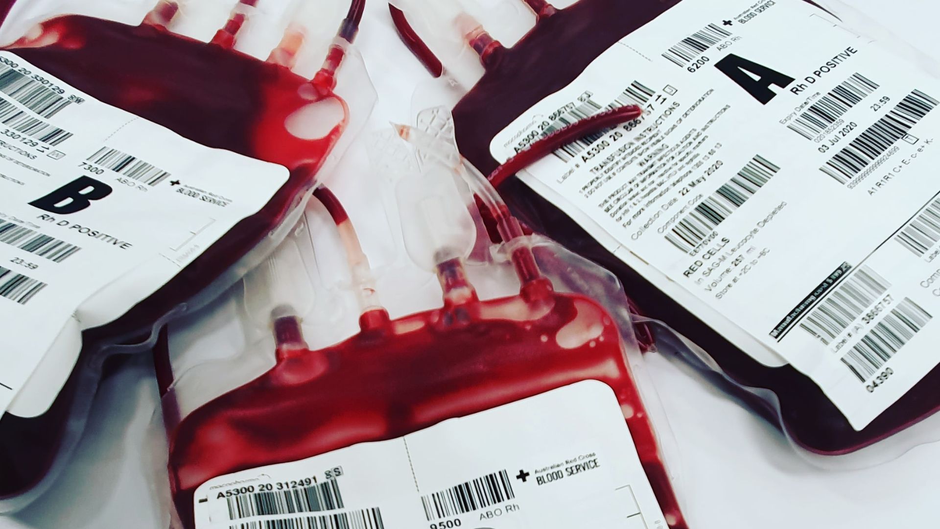 Nhóm máu AB truyền được cho nhóm máu nào là câu hỏi được nhiều người quan tâm