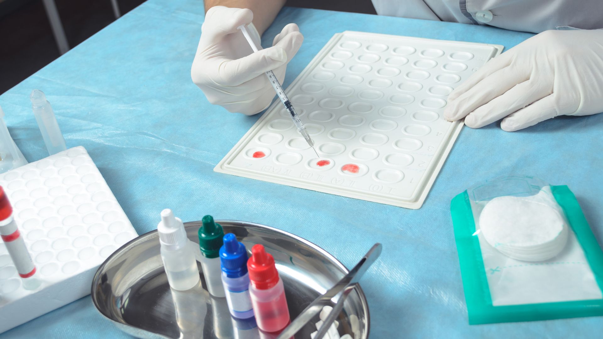 Xét nghiệm xác định yếu tố Rh nhằm xác định sự có mặt của kháng nguyên D trên bề mặt hồng cầu