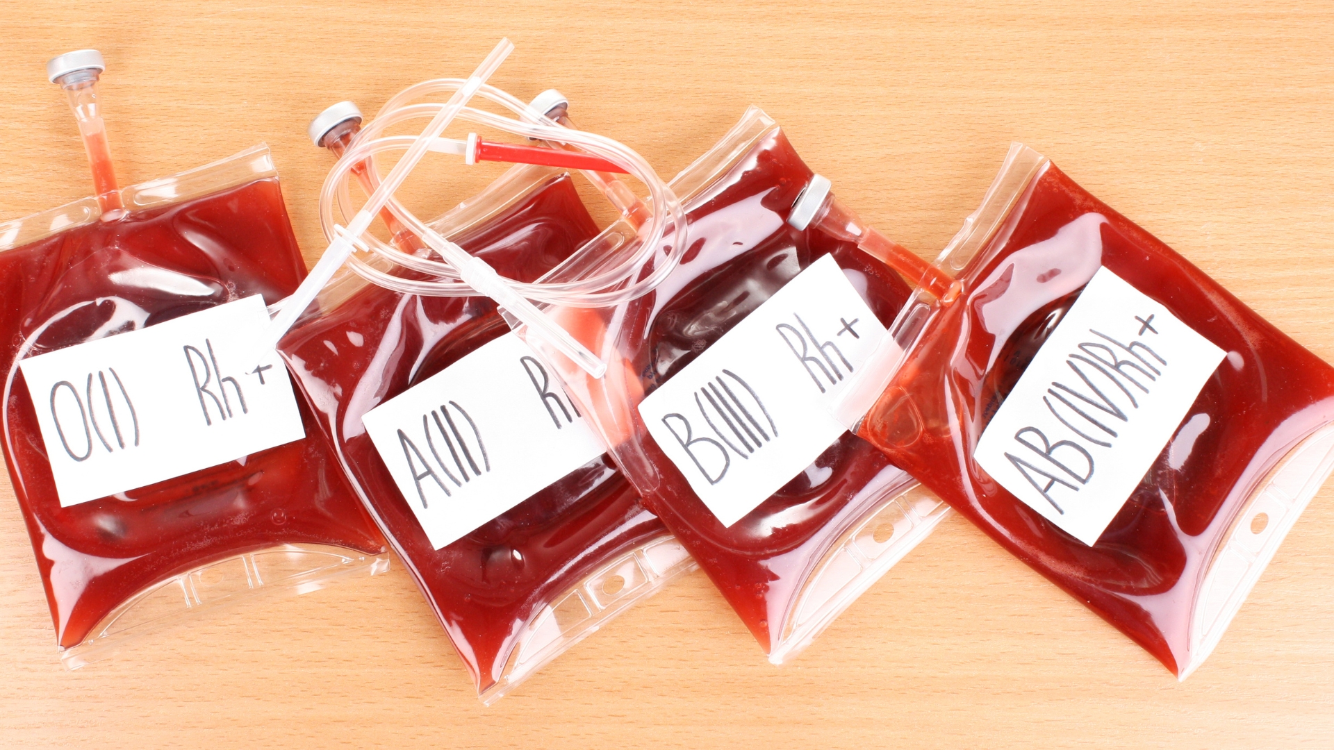 Người mang máu B có thể truyền máu cho nhóm B và nhóm AB nhưng chỉ nhận được máu từ nhóm O và nhóm B