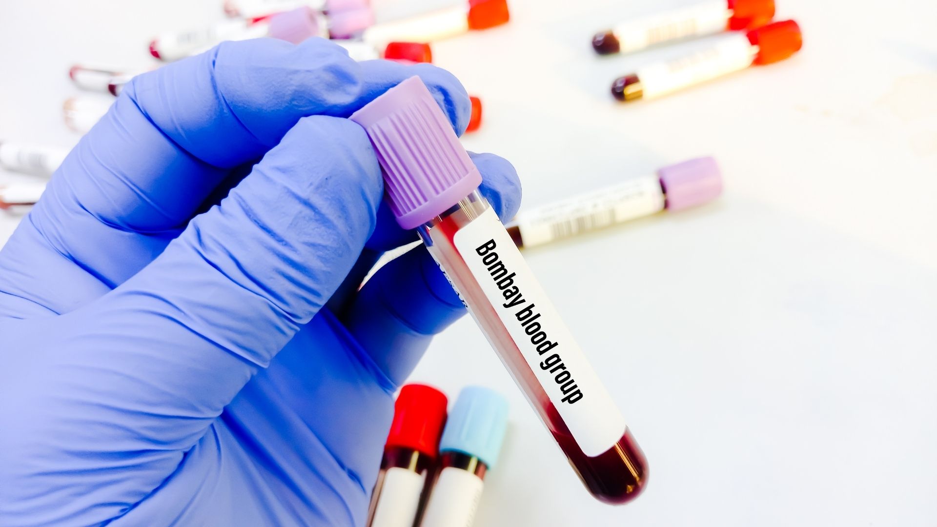 Nhóm máu Bombay cũng là nhóm máu đặc biệt hiếm, không thể nhận máu từ nhóm ABO và cả nhóm O
