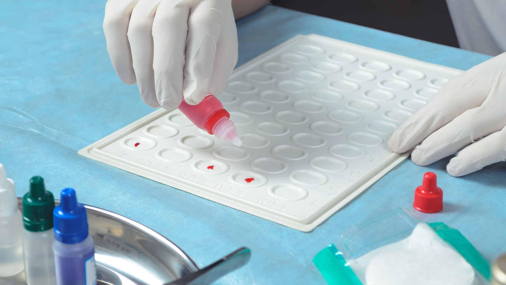 Hệ Rh là hệ thống thứ hai được sử dụng phổ biến dựa trên sự hiện diện của kháng nguyên D