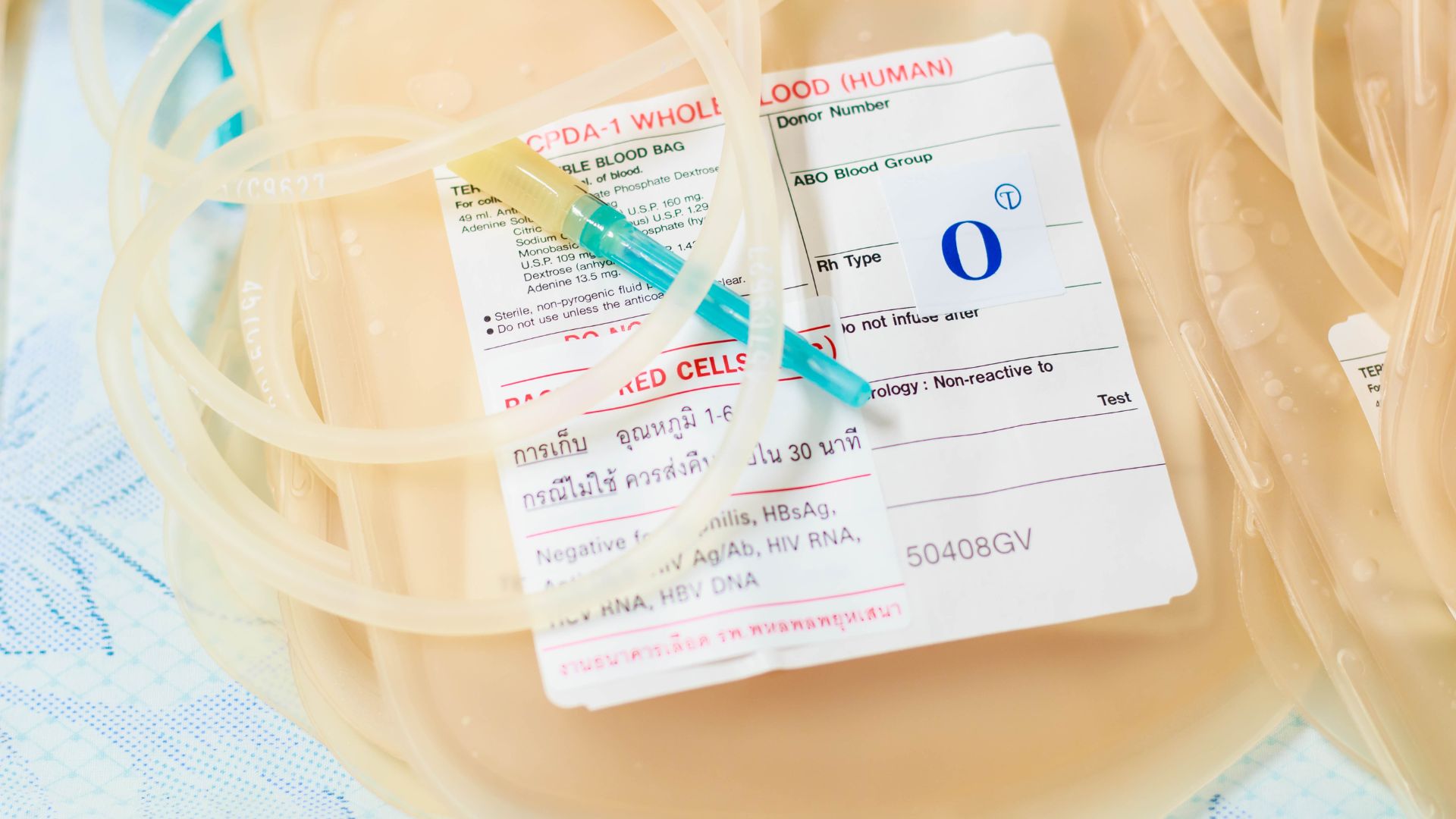 Nhóm máu O trong di truyền học được xác định bởi kiểu gen lặn