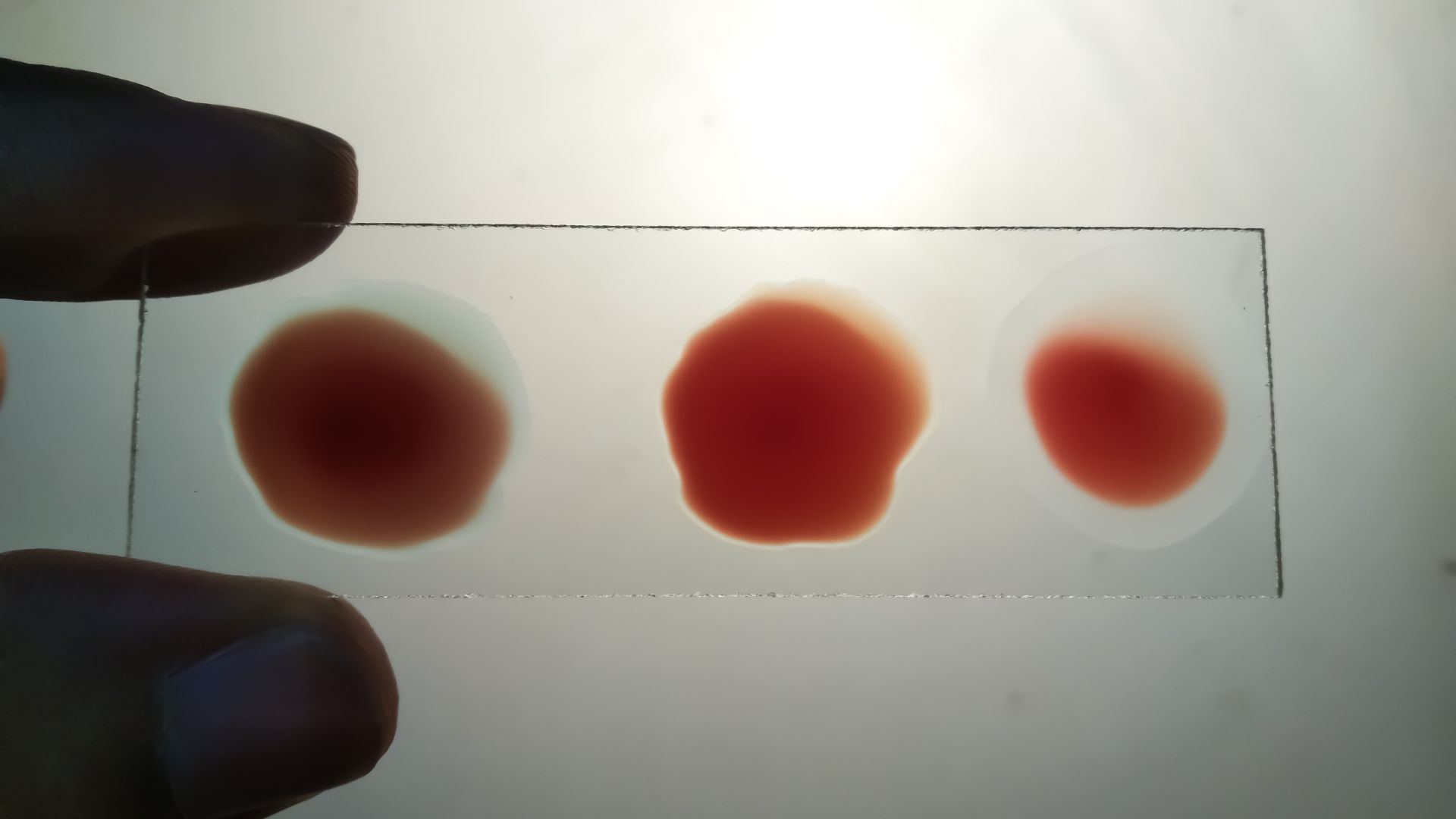 Xét nghiệm ngưng kết trực tiếp là phương pháp thường dùng để xác định nhóm máu dựa trên phản ứng giữa kháng thể và kháng nguyên