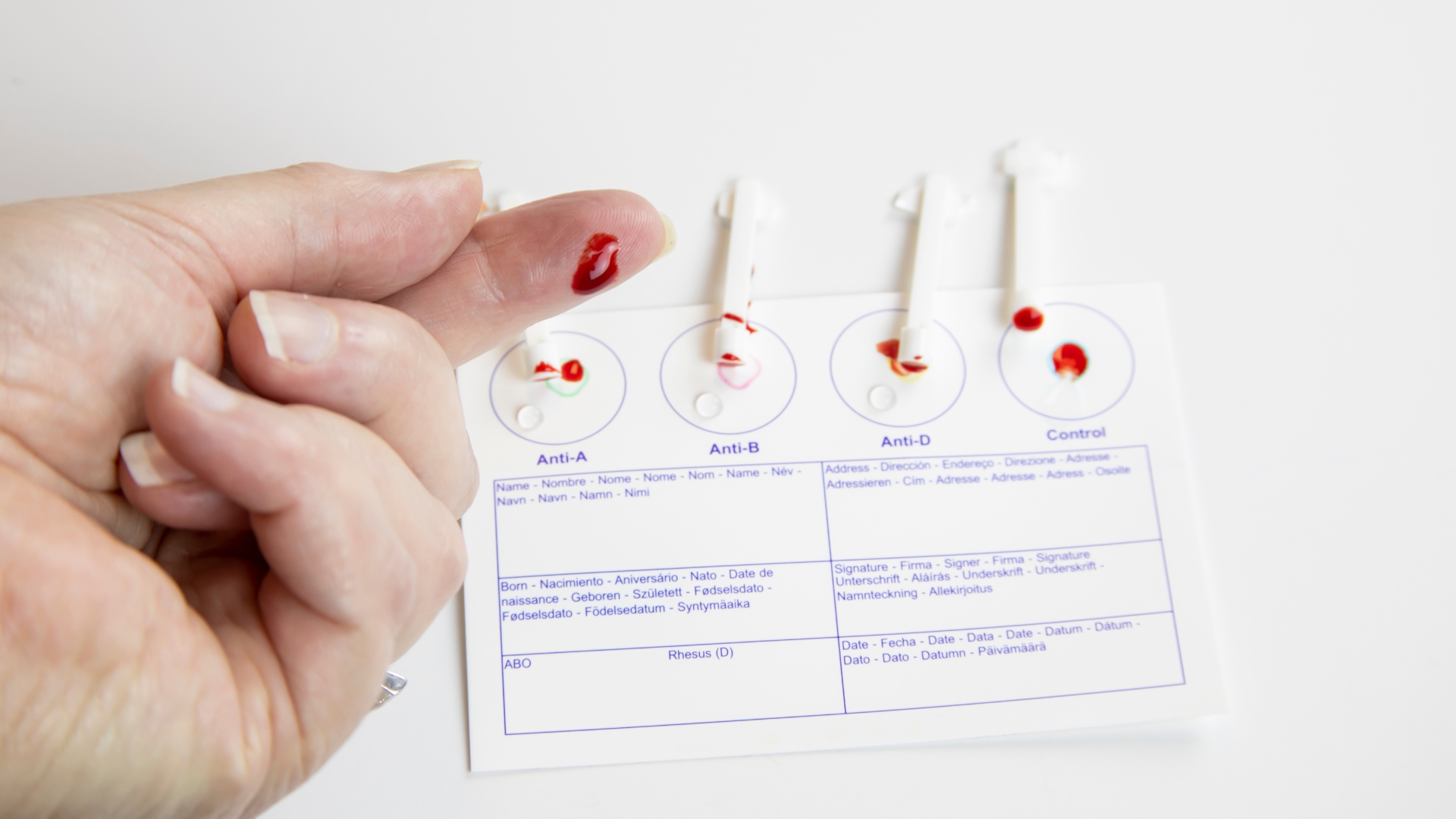 Hiện nay có một số bộ kit thử nhóm máu sử dụng lượng máu nhỏ để kiểm tra phản ứng với các kháng thể đặc hiệu