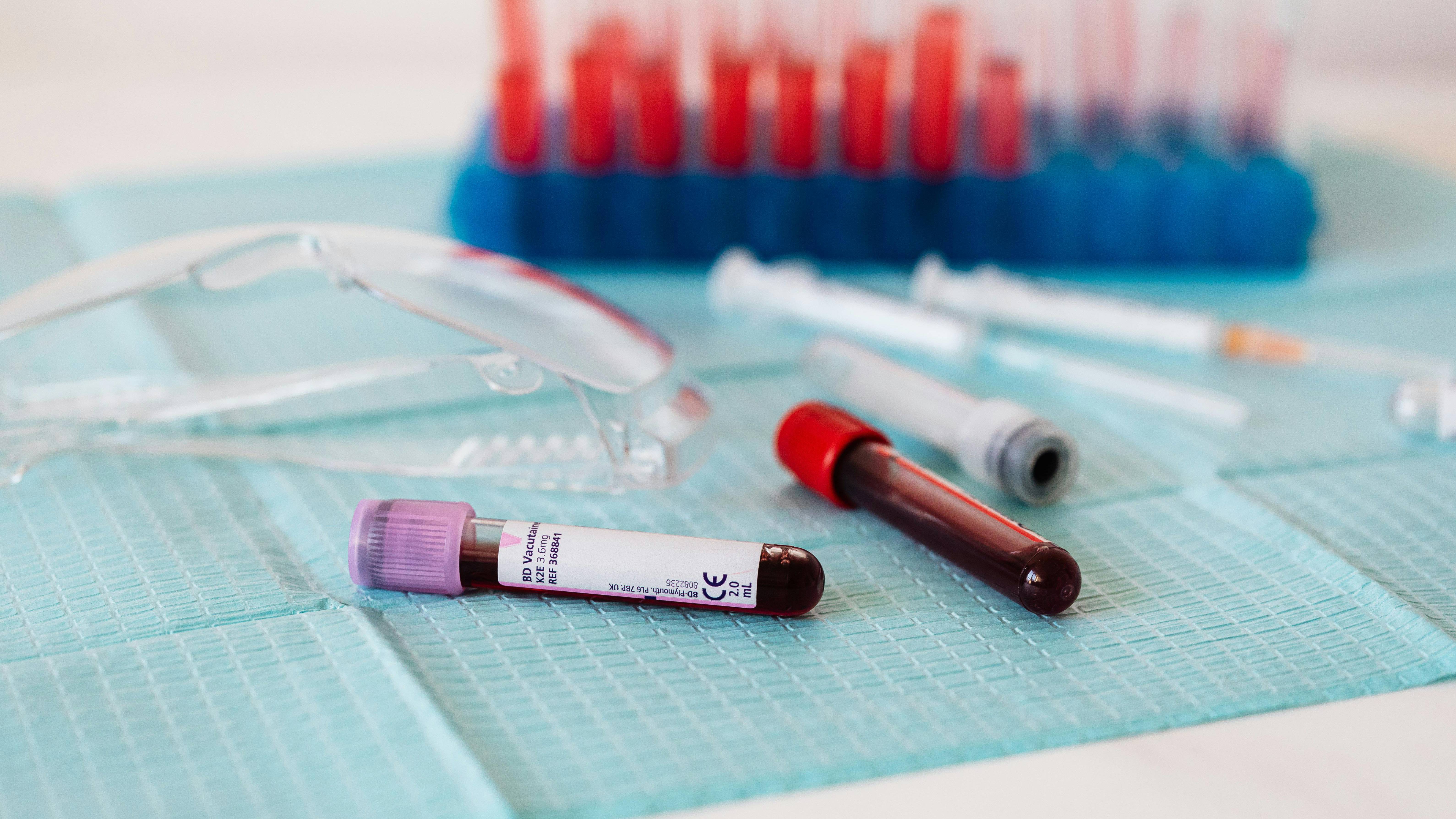 Xét nghiệm máu là một trong các kỹ thuật được dùng để đánh giá chính xác mức độ tổn thương tim