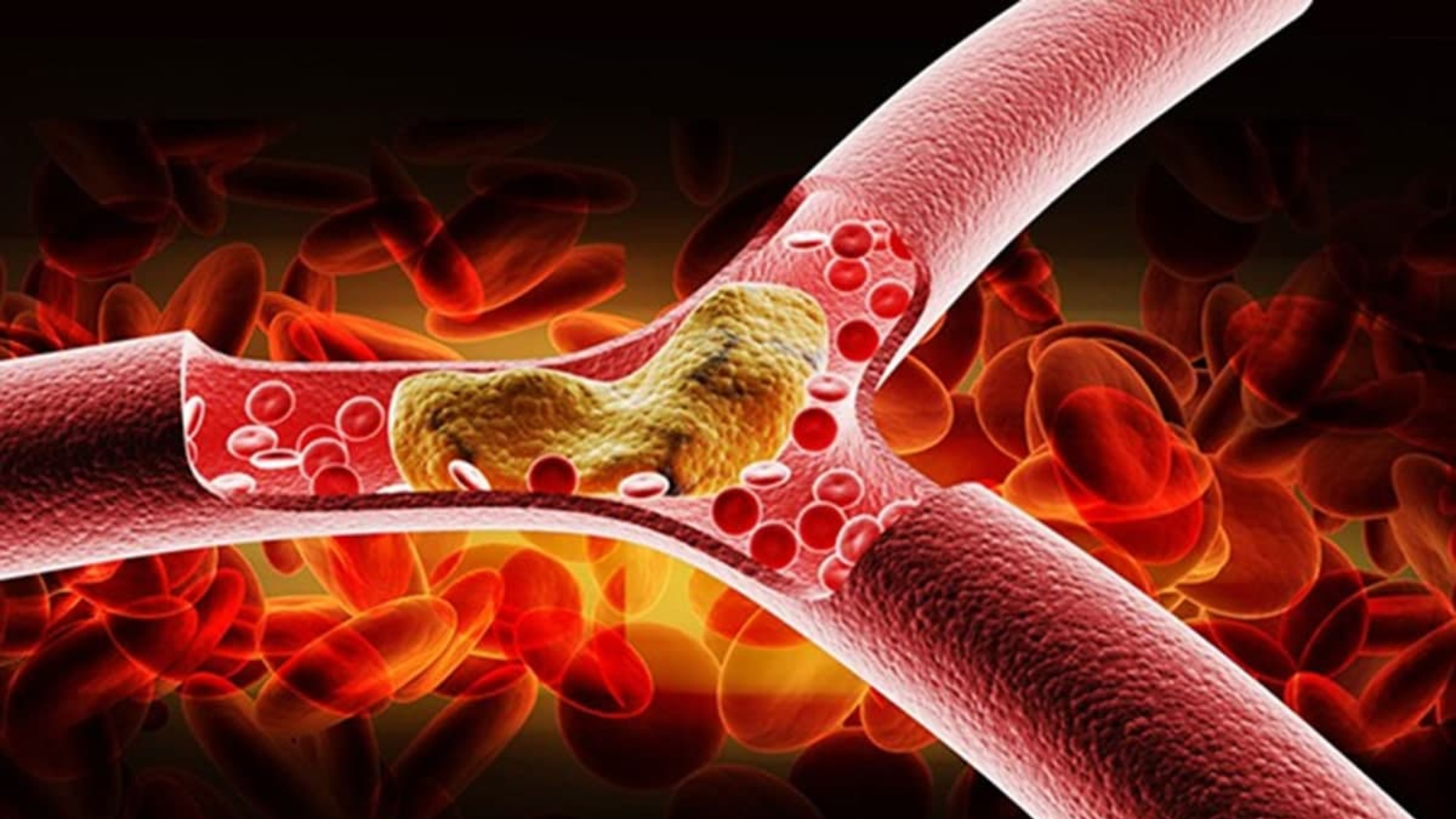 Sữa dành cho người mỡ máu cao là vấn đề được nhiều người quan tâm