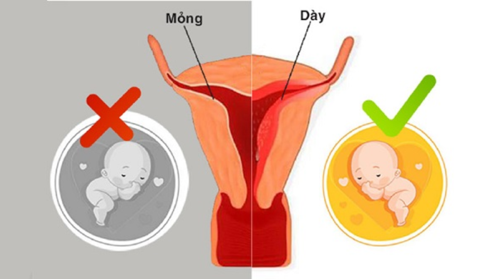 Những thông tin quan trọng về niêm mạc tử cung chị em cần biết 4