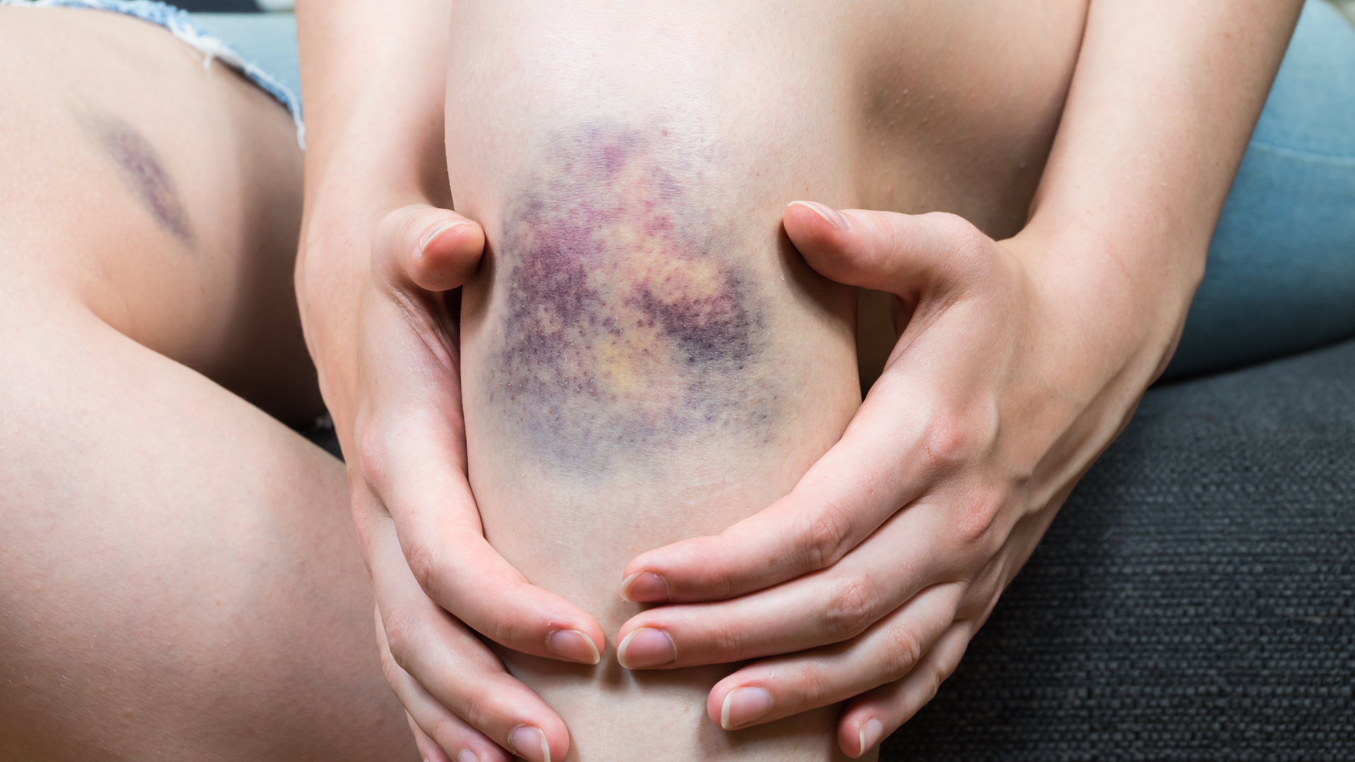 Những triệu chứng xơ gan cổ trướng và cách phòng ngừa 2