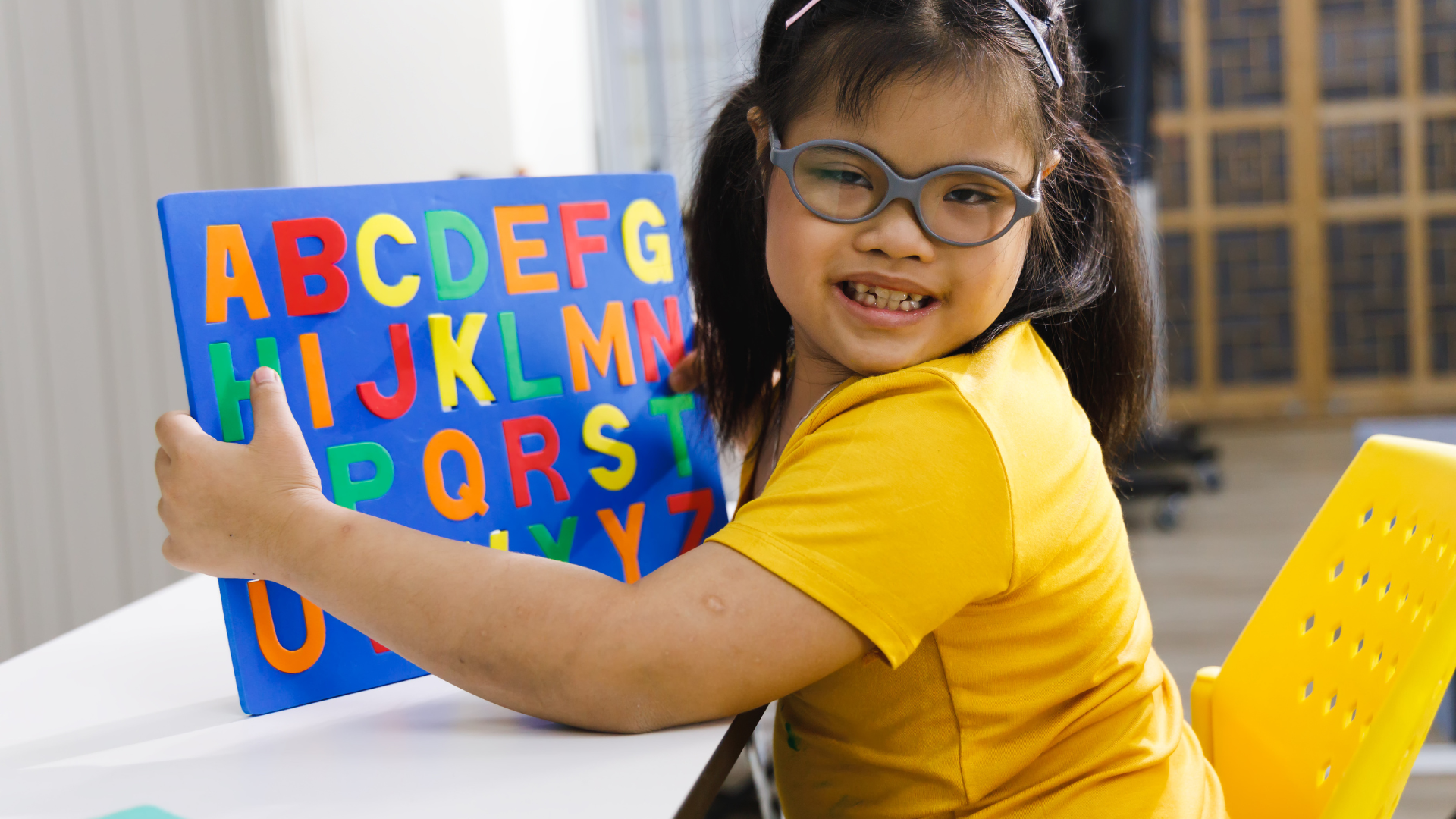 Hội chứng Down là bất thường nhiễm sắc thể phổ biến nhất còn sống sau sinh