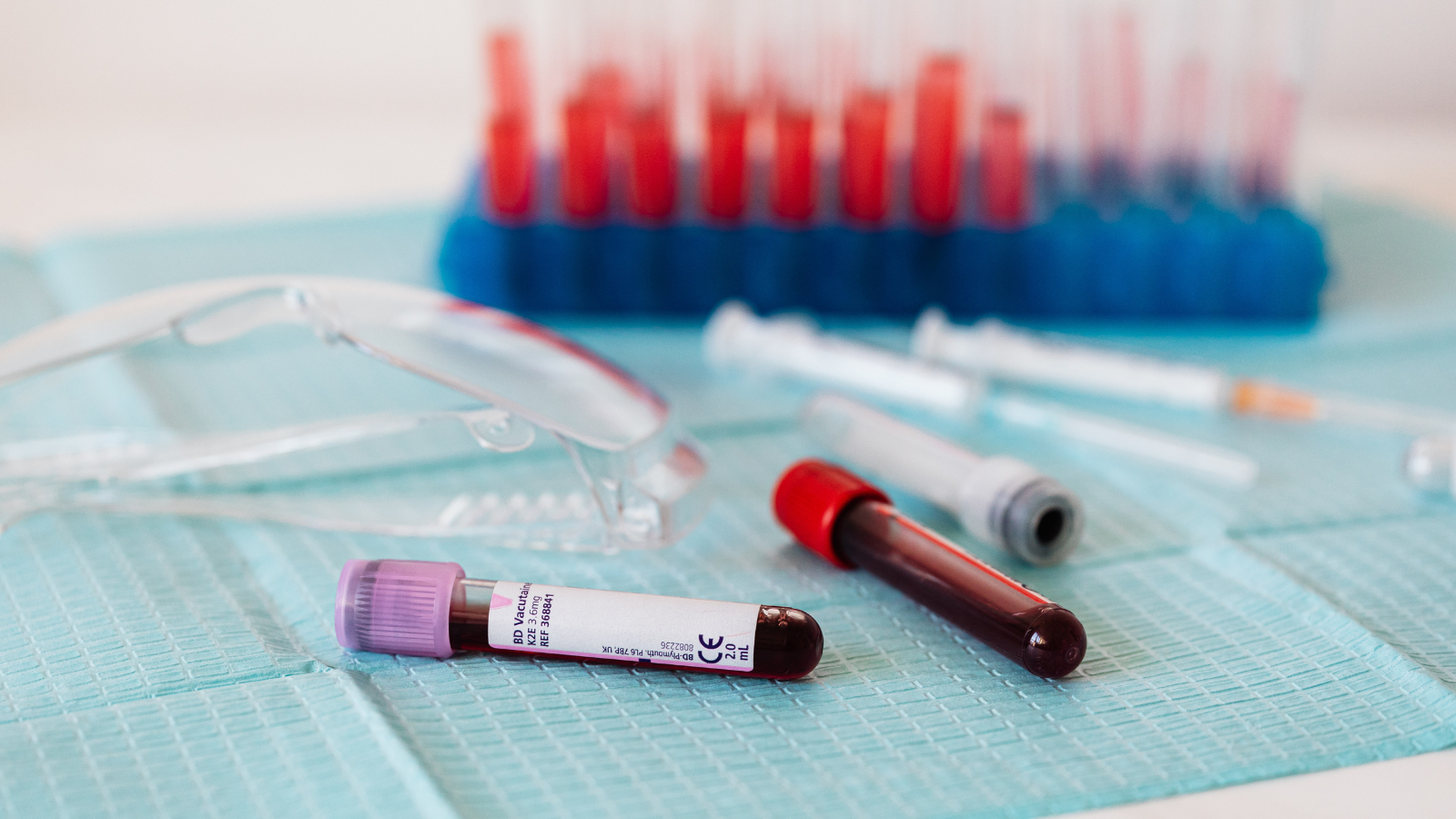 Xét nghiệm cơ bản như công thức máu toàn phần