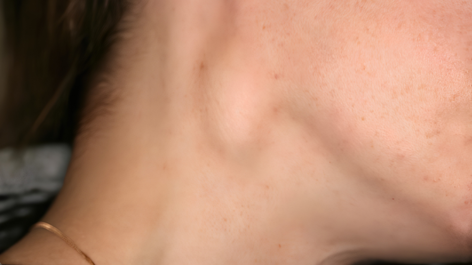 Nổi hạch ở má phải có sao không là thắc mắc của nhiều người