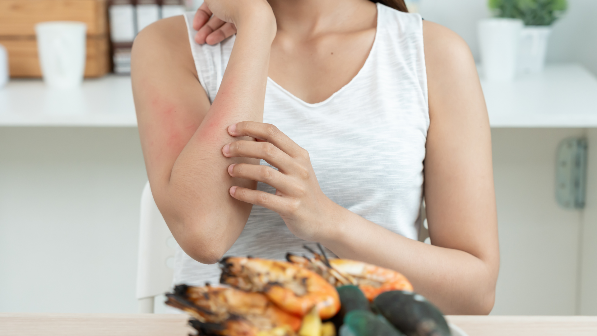 Nổi mề đay cấp tính thường xảy ra khi hệ miễn dịch phản ứng quá mức với một yếu tố nào đó