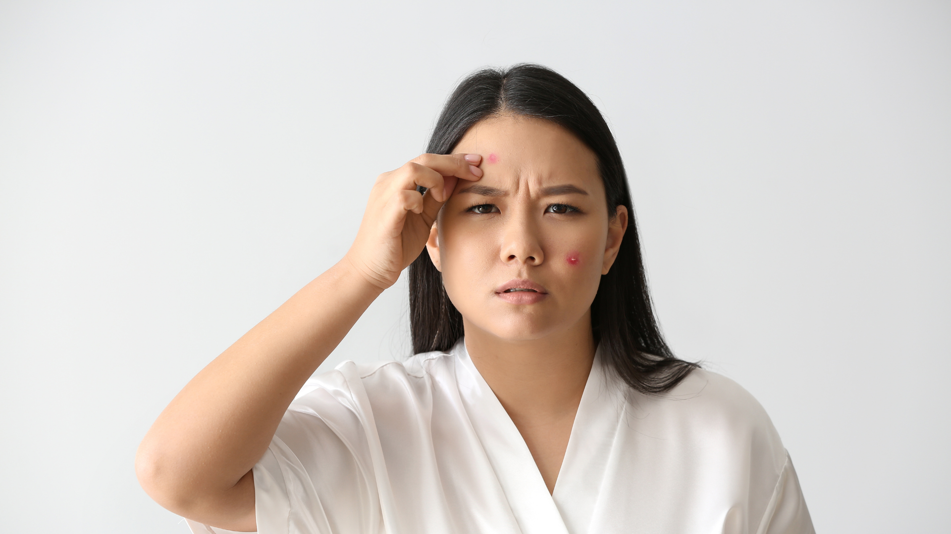 Nổi mụn nhọt liên tục: Dấu hiệu cảnh báo sức khỏe bạn không nên bỏ qua 3