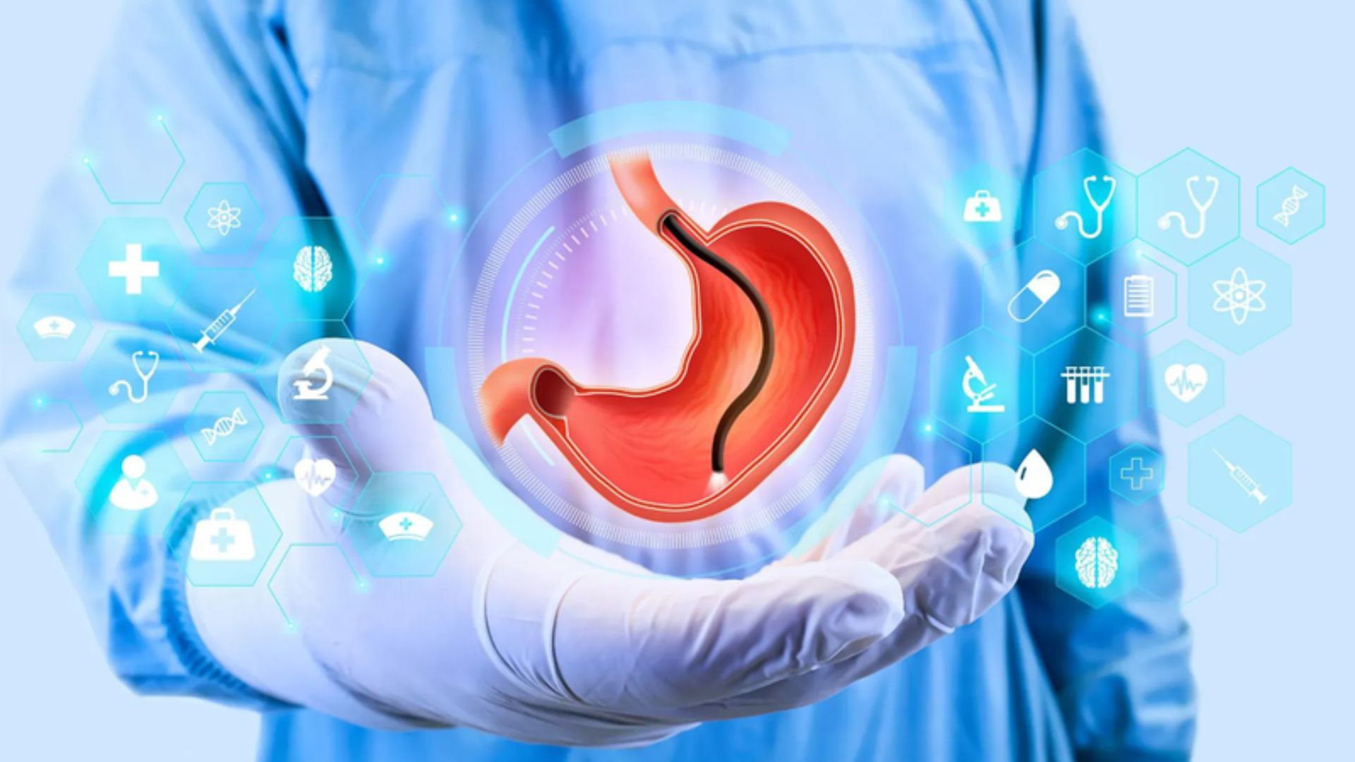 Nội soi dạ dày gây mê: Quy trình, mức độ an toàn và những điều cần lưu ý 3