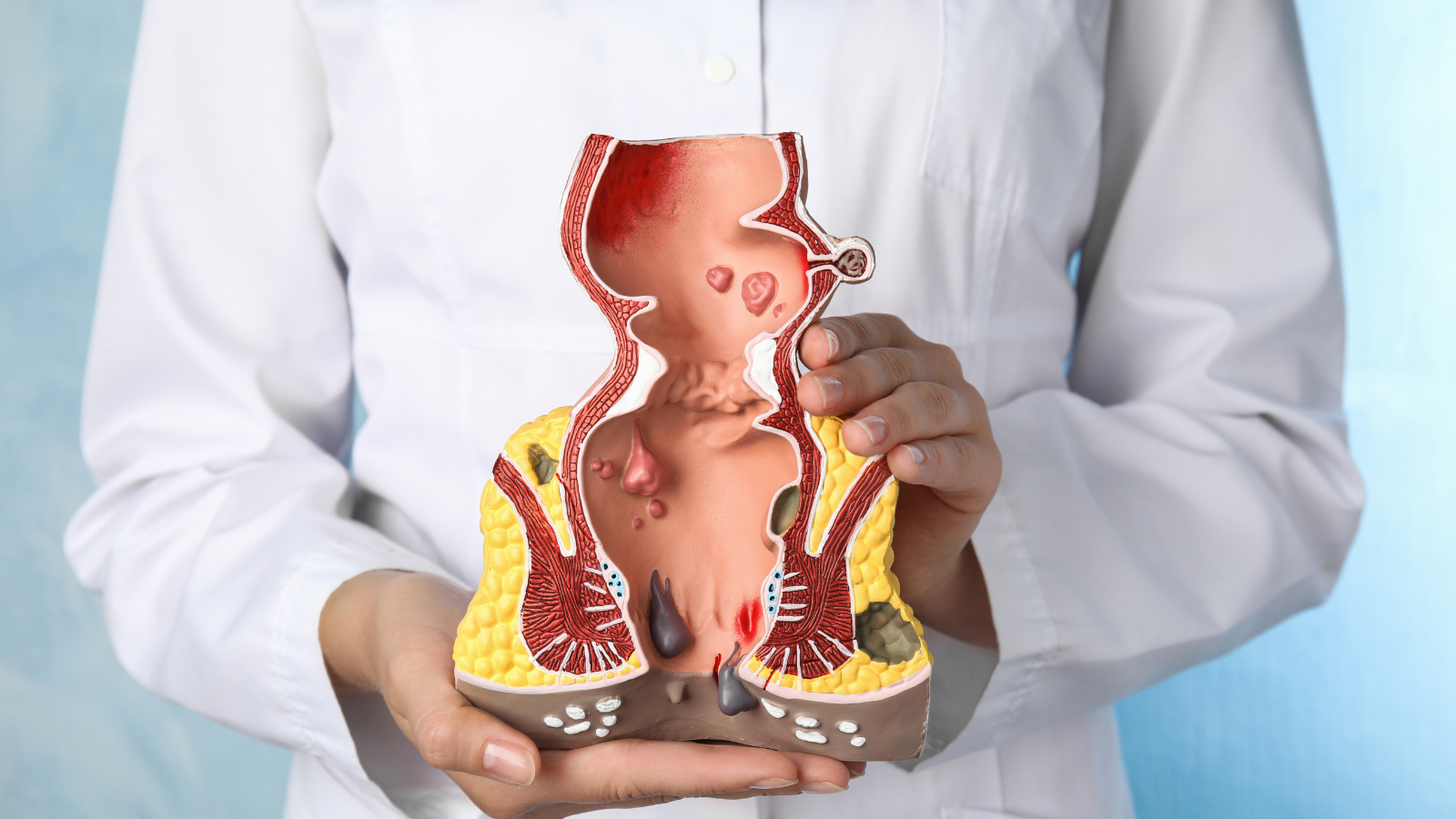 Nội soi đại tràng có đau không? Làm gì để giảm khó chịu? 1