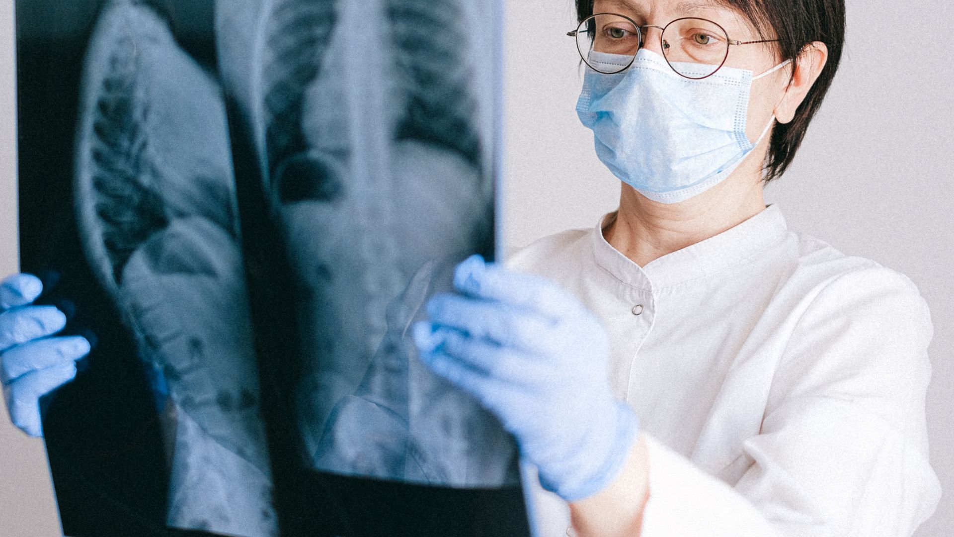 Nội soi màng phổi thường được chỉ định khi tràn dịch màng phổi không rõ nguyên nhân