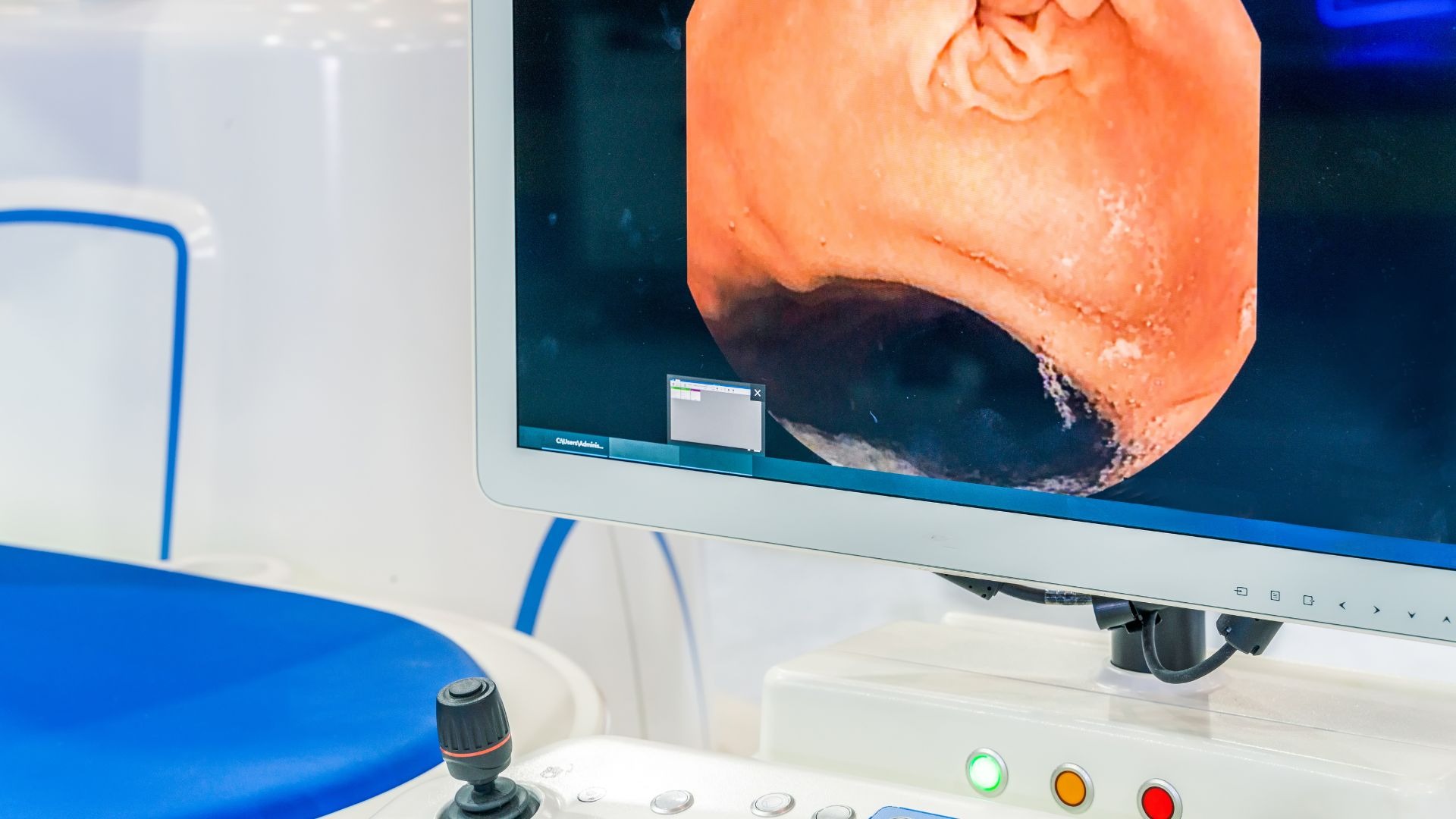 Nội soi ổ bụng giúp quan sát trực tiếp hình ảnh các vị trí như gan, ruột, dạ dày,...