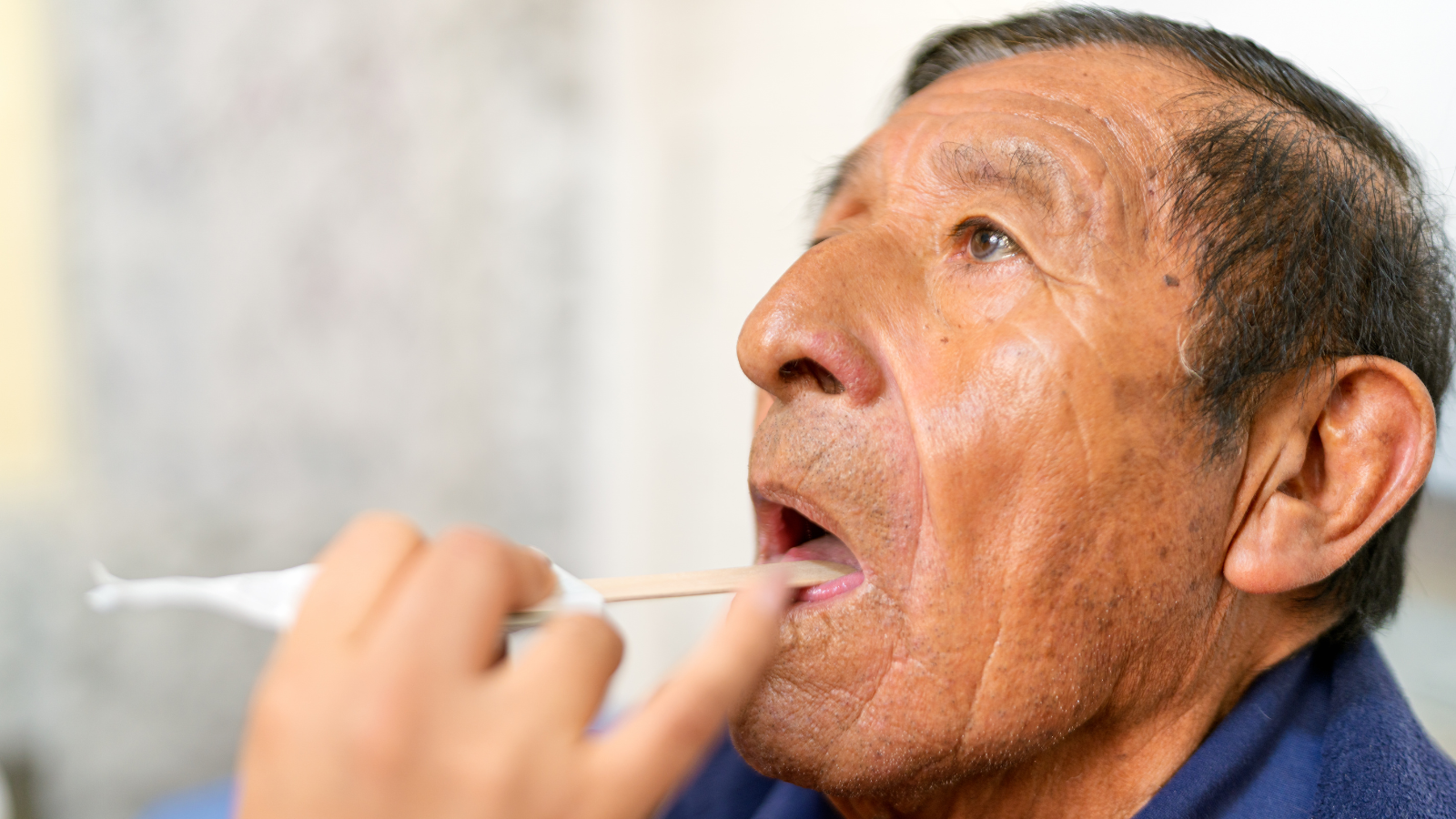 Nội soi tai mũi họng là phương pháp cận lâm sàng quan trọng để đánh giá amidan