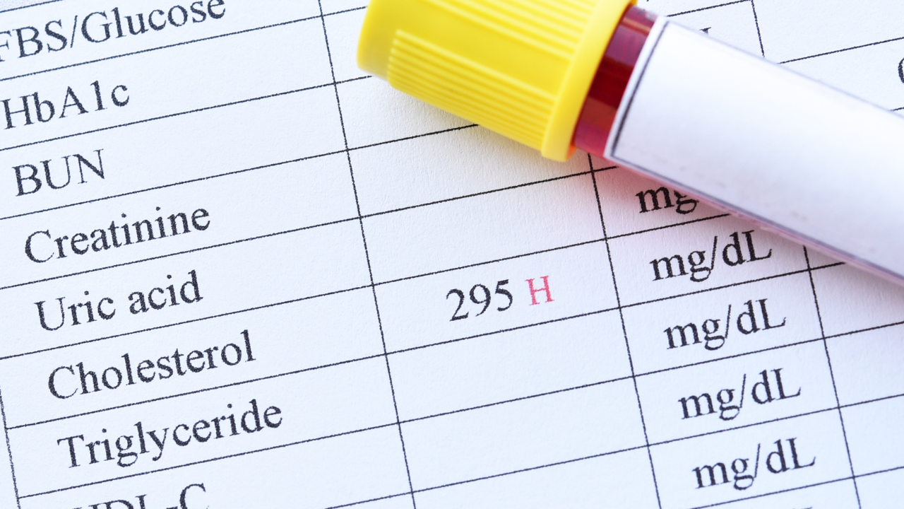 Nồng độ beta hCG xuất hiện trong máu và nước tiểu