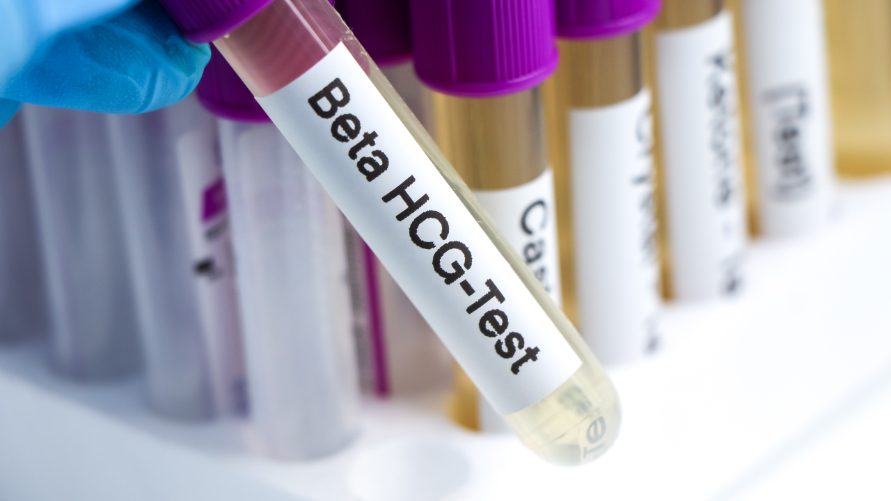 Các xét nghiệm bổ sung để đánh giá chính xác tình trạng thai kỳ
