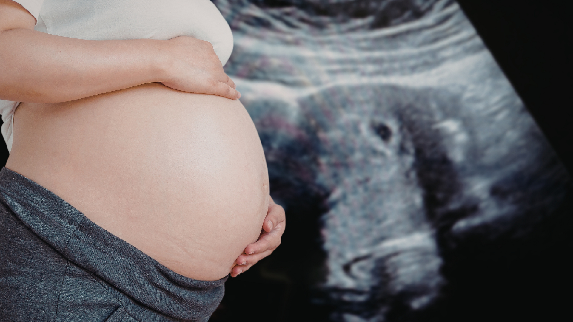 Nốt vôi hoá ở tim thai thường không ảnh hưởng chức năng tim