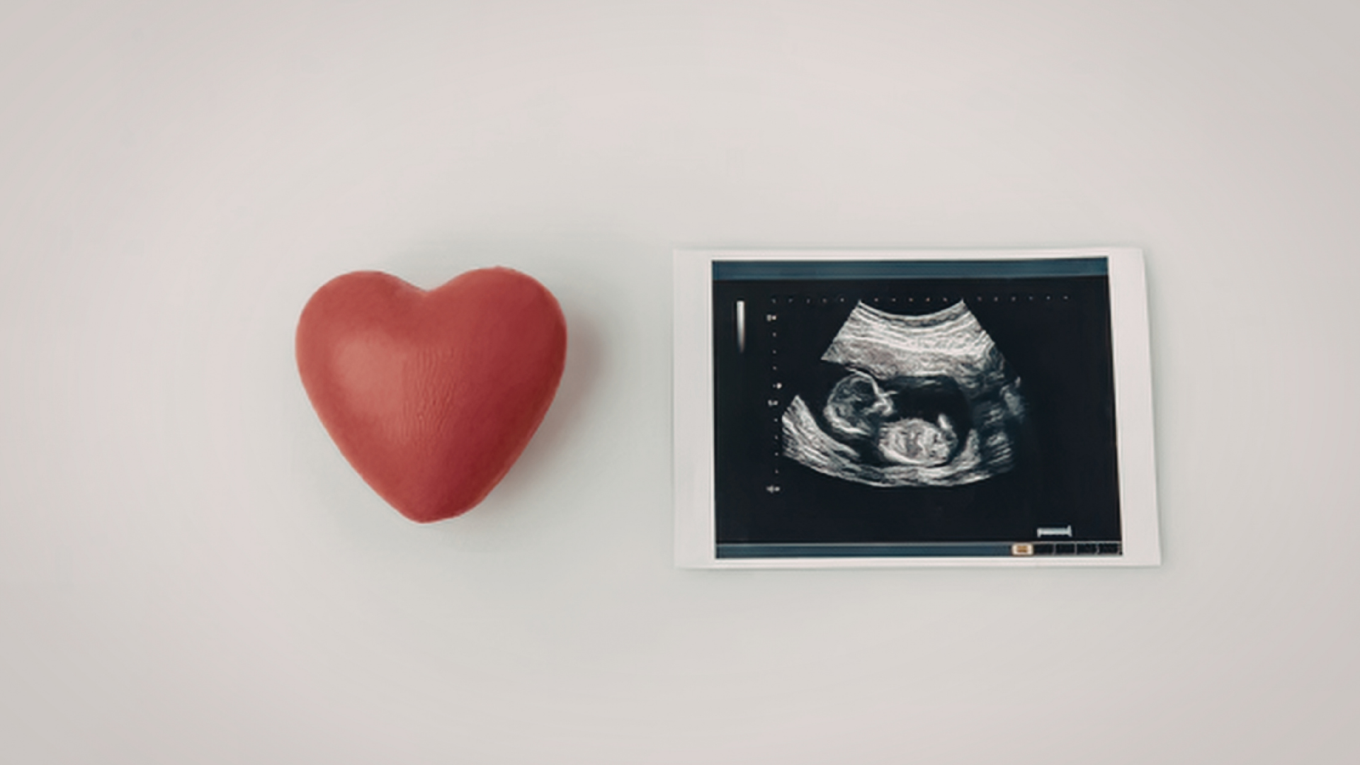 Sự lắng đọng canxi có thể tạo nên điểm sáng trong tim thai