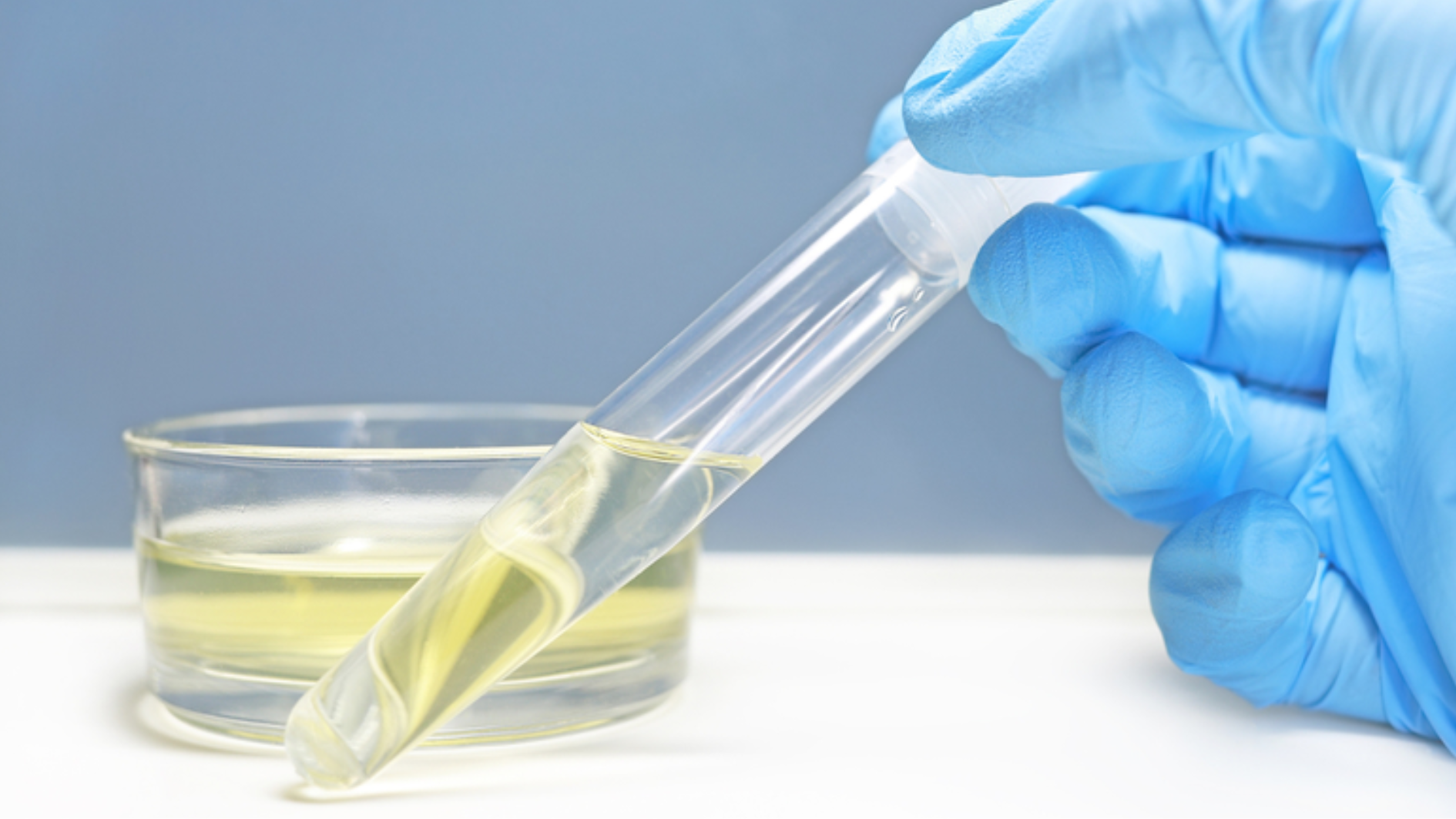 Nước tiểu màu gì là tốt?