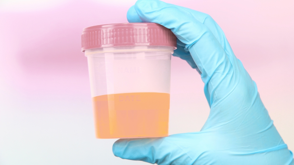 Tìm hiểu về tình trạng nước tiểu màu hồng nhạt ở trẻ em