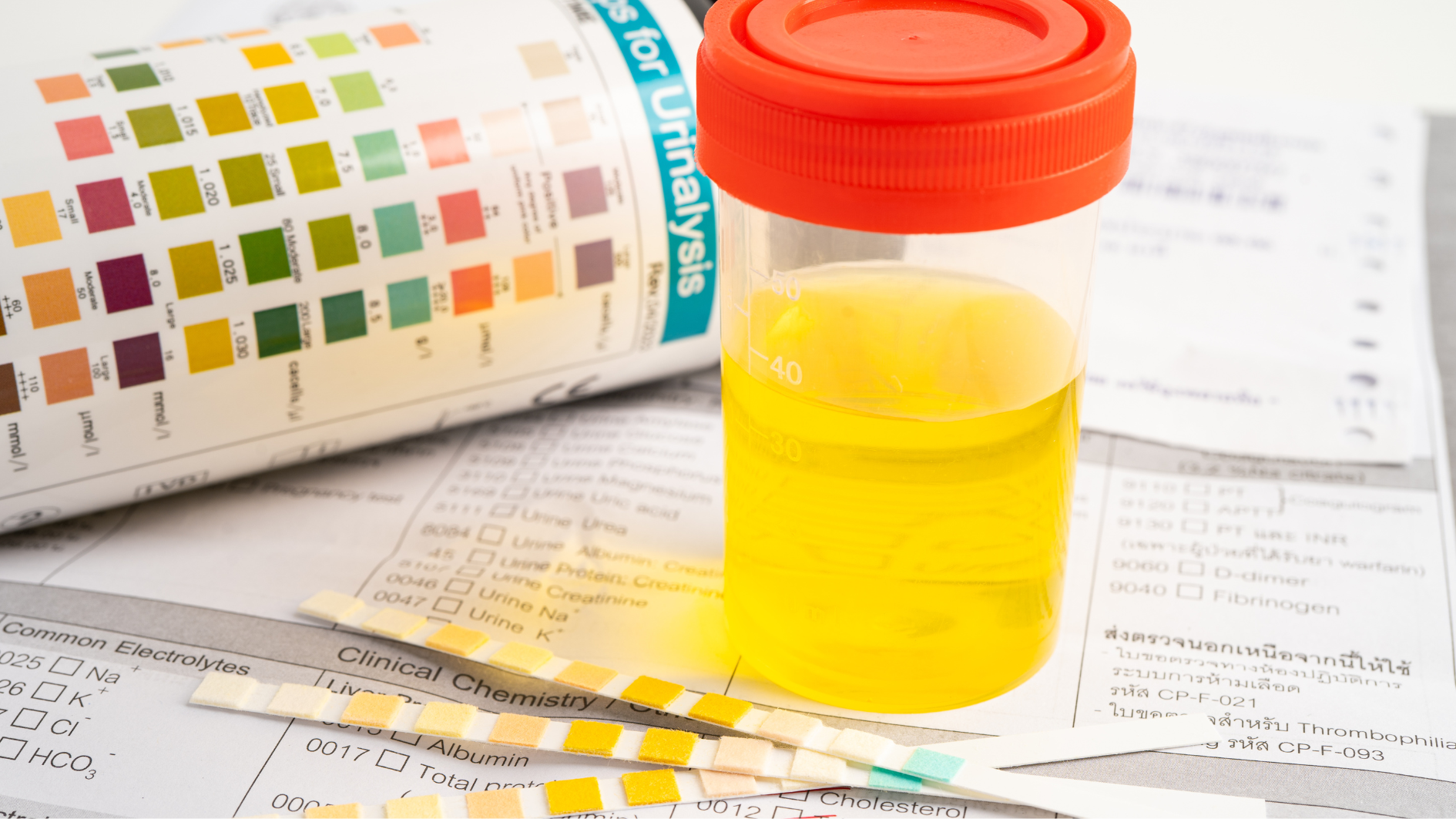 Nước tiểu trẻ sơ sinh màu vàng có thể bị ảnh hưởng từ chế độ ăn của mẹ