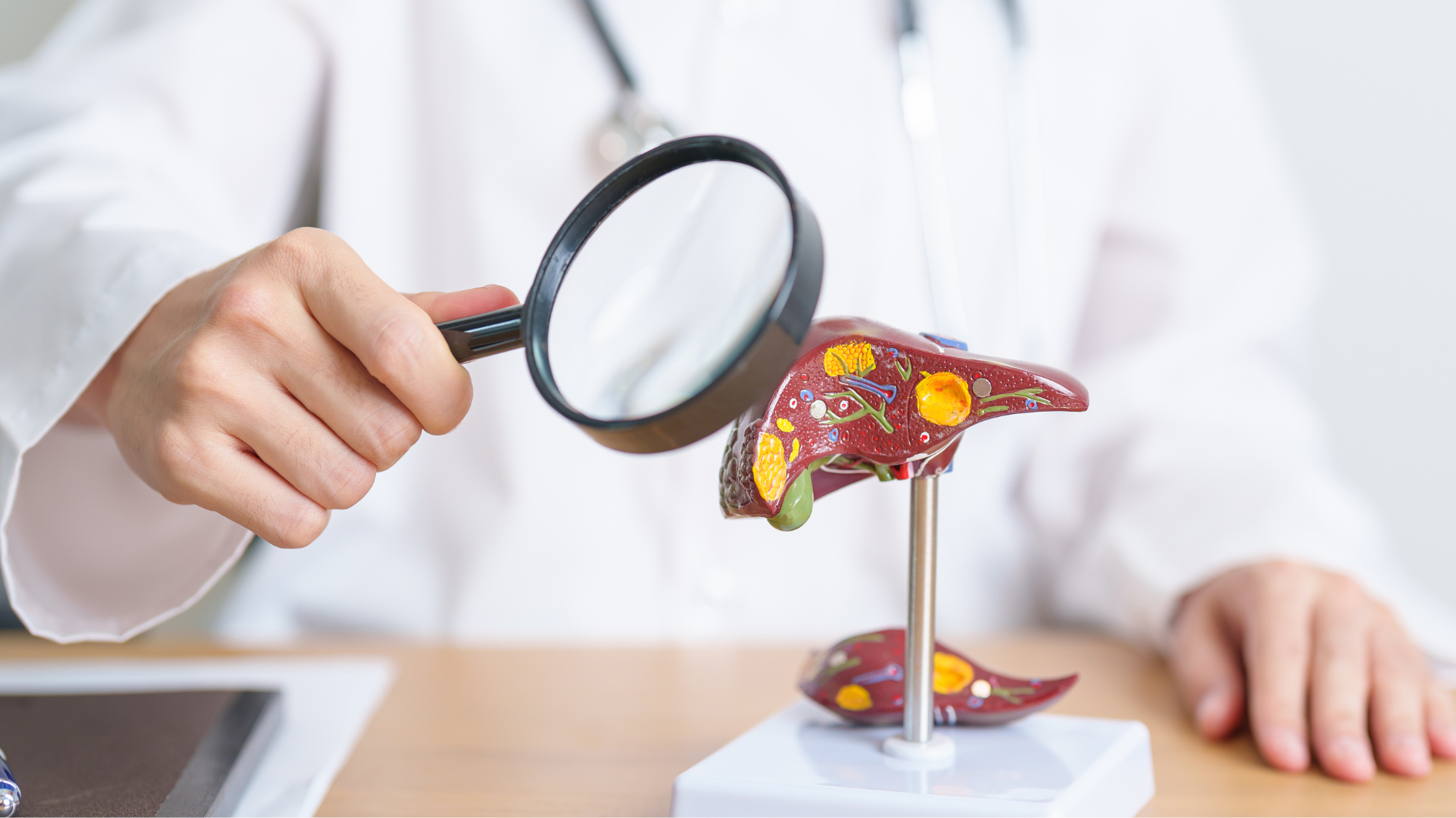 Trẻ bị viêm gan có thể gây nước tiểu màu vàng