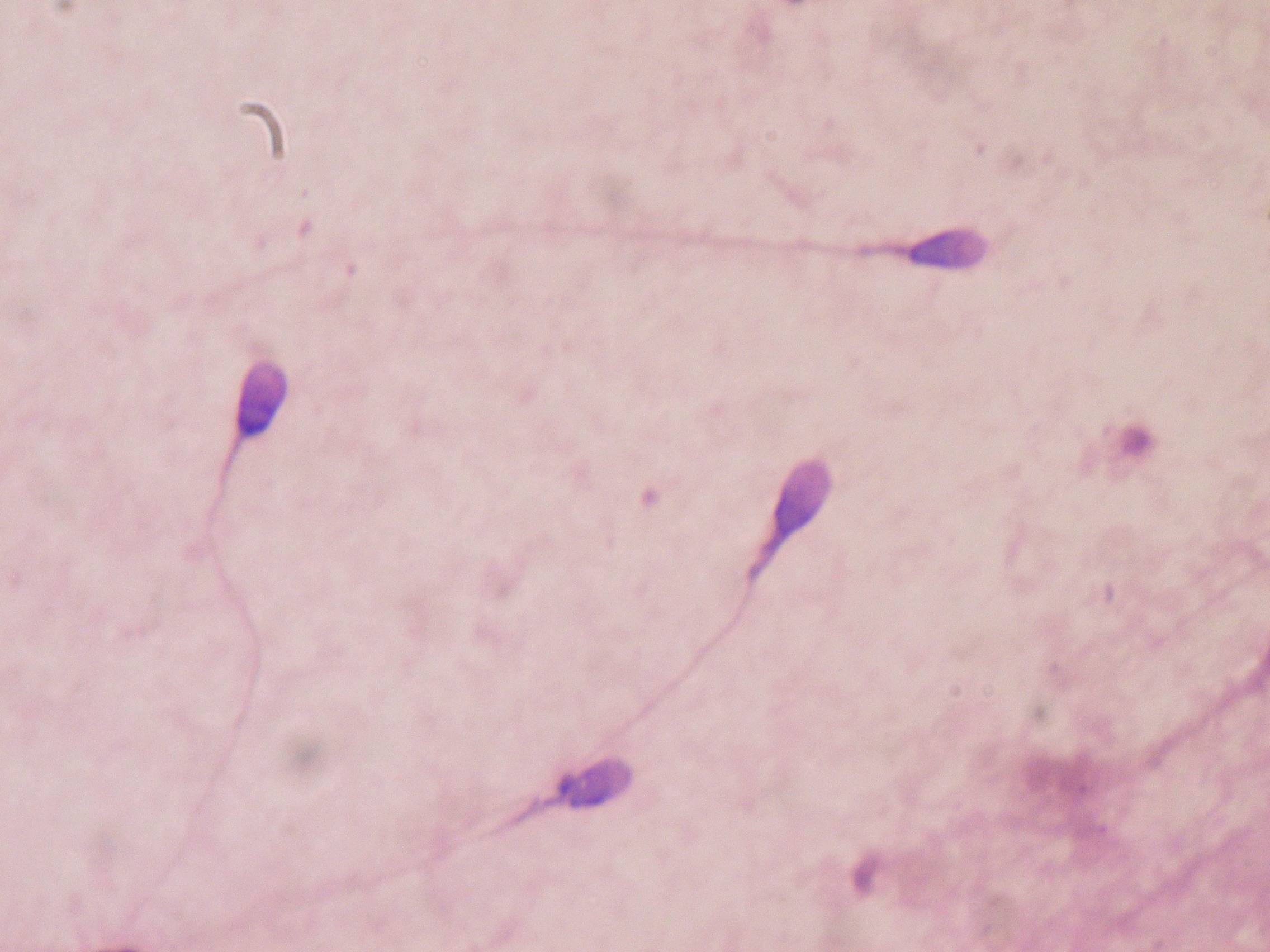 Nuốt tinh trùng có bị HIV không? Cách phòng ngừa HIV và các bệnh lây truyền qua đường tình dục 1