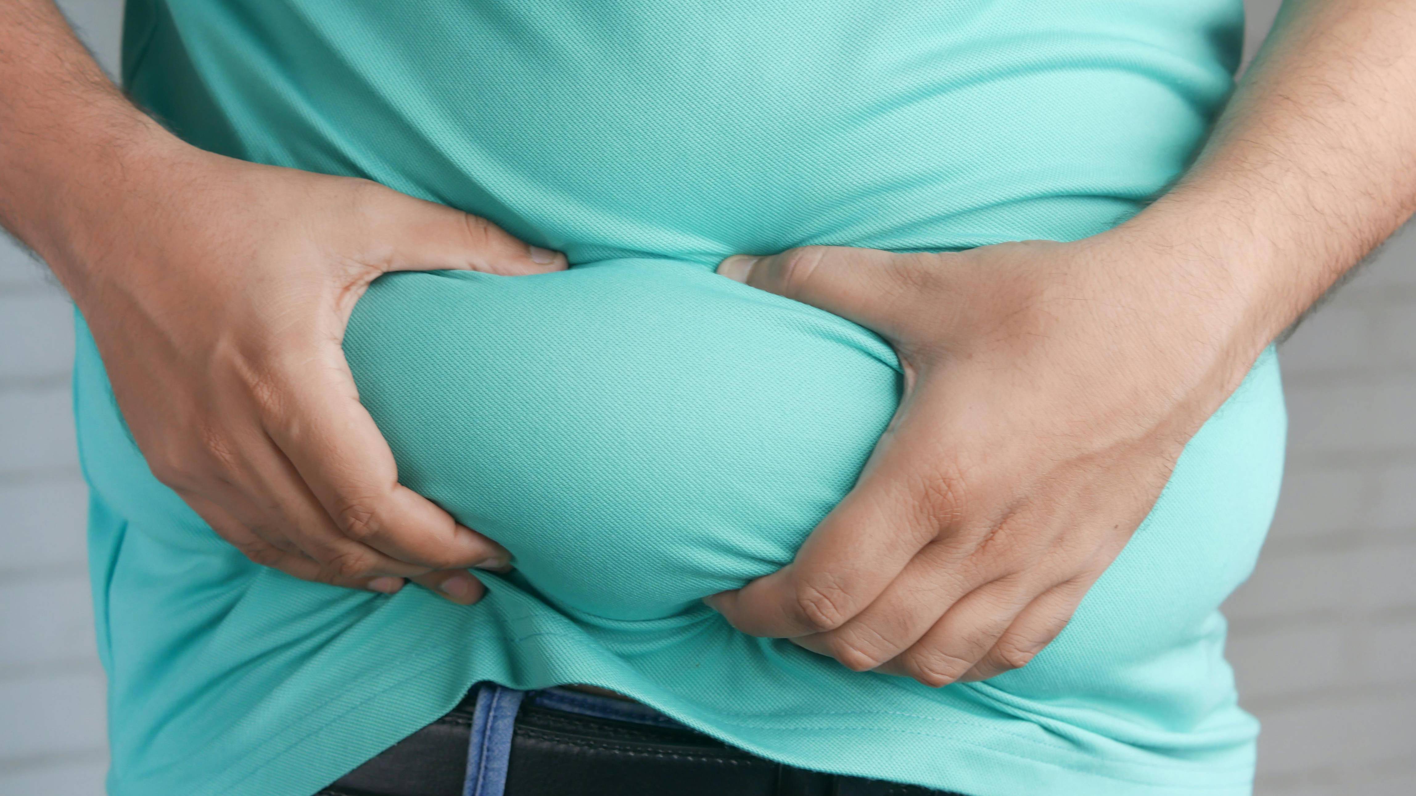 Người thừa cân, béo phì dễ gặp tình trạng nứt gót chân do phải chịu áp lực lớn hơn lên bàn chân