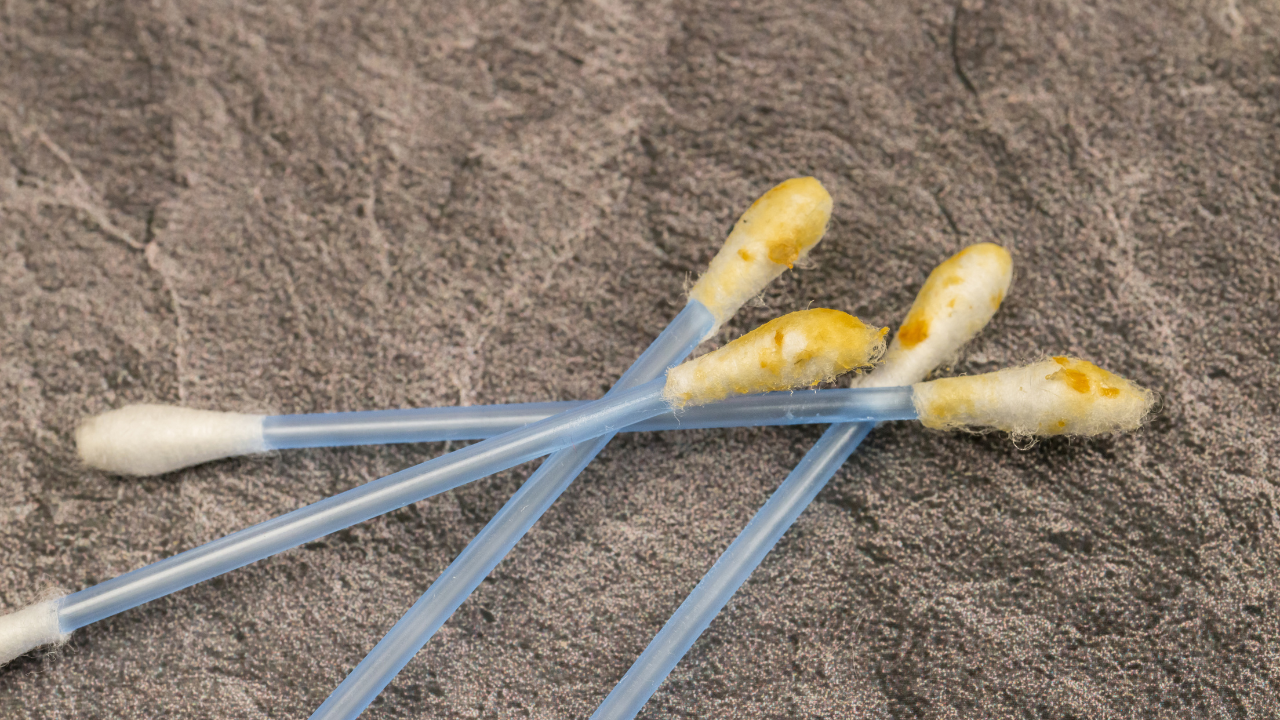 Chỉ nên vệ sinh tai cho trẻ khi thực sự cần thiết