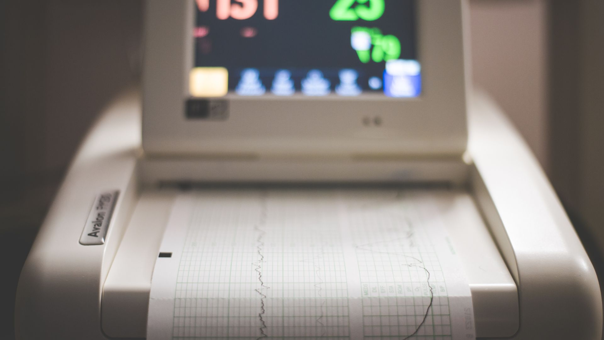 Thai máy yếu là một dấu hiệu nhận biết ối vỡ non